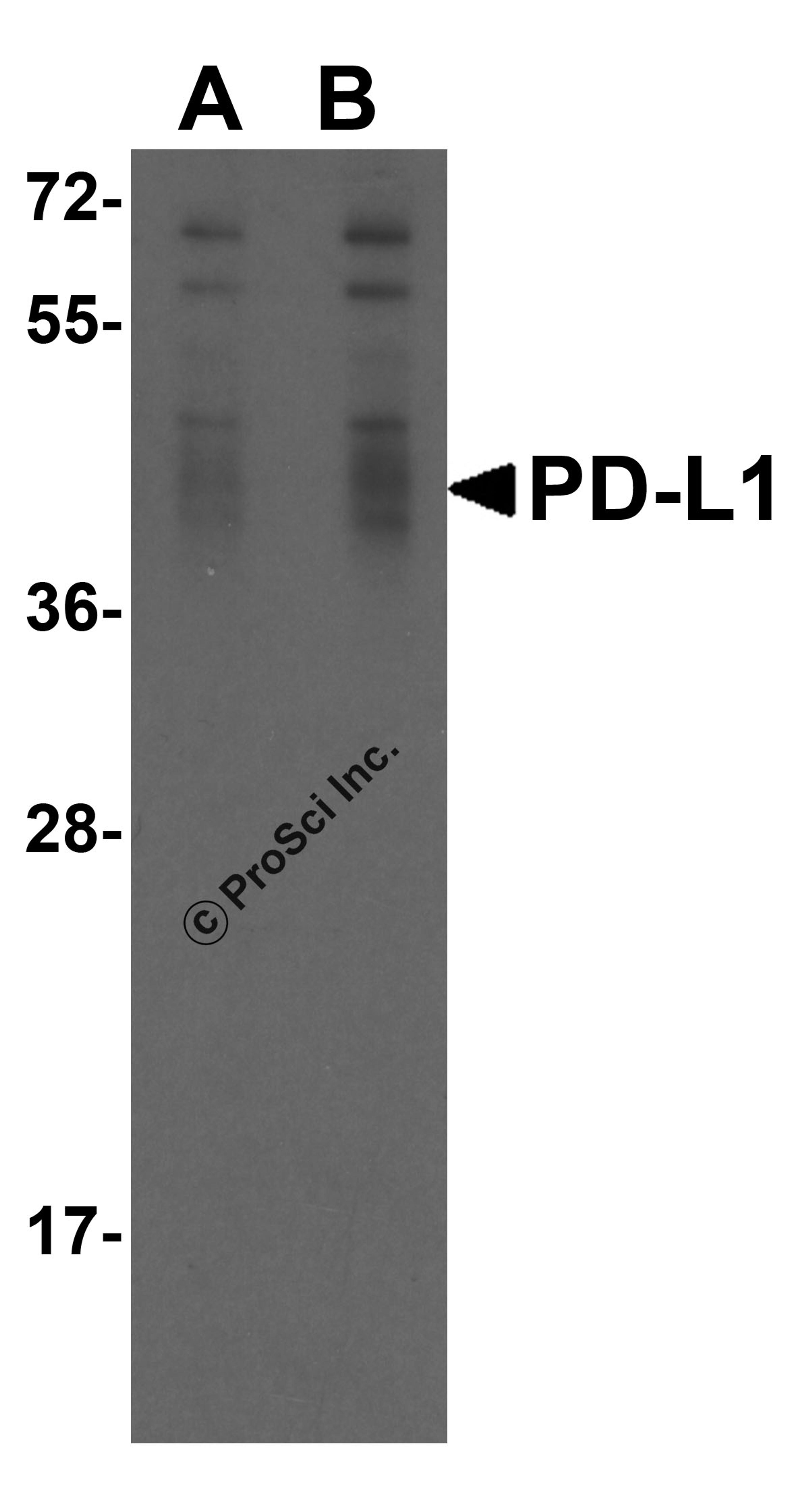<strong>Figure 1 Overexpression Validation of PD-L1 in 293 Cells </strong><br>
Loading: 15 μg of lysates per lane.
Antibodies: RF16035 (A, 0.25 μg/mL; B, 0.5 μg/mL), 1 h incubation at RT in 5% NFDM/TBST.
Secondary: Goat anti-mouse IgG HRP