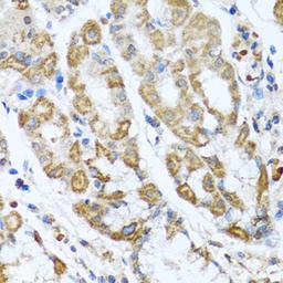 Immunohistochemistry  - ANTXR2 antibody (A6526)