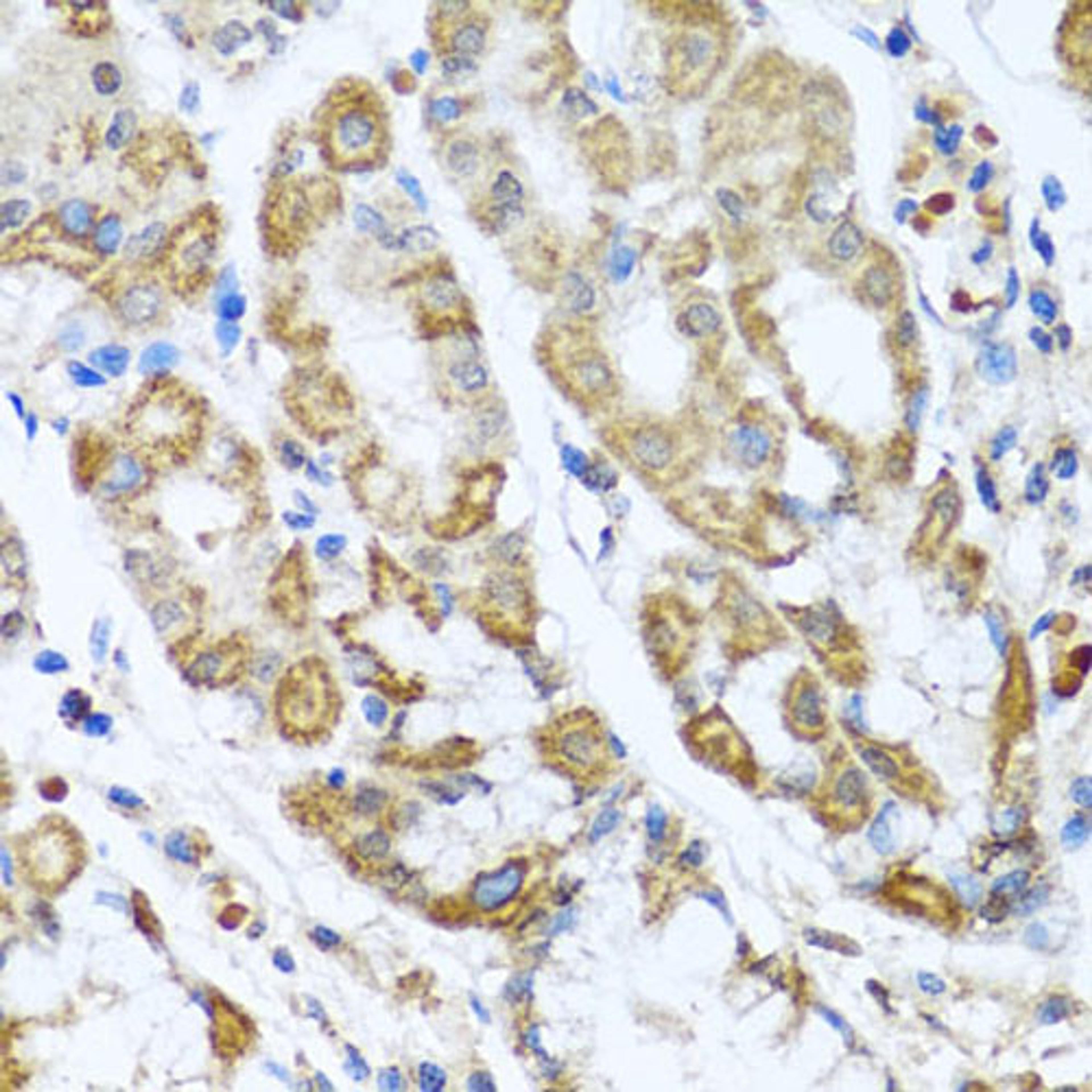 Immunohistochemistry - ANTXR2 antibody (A6526)