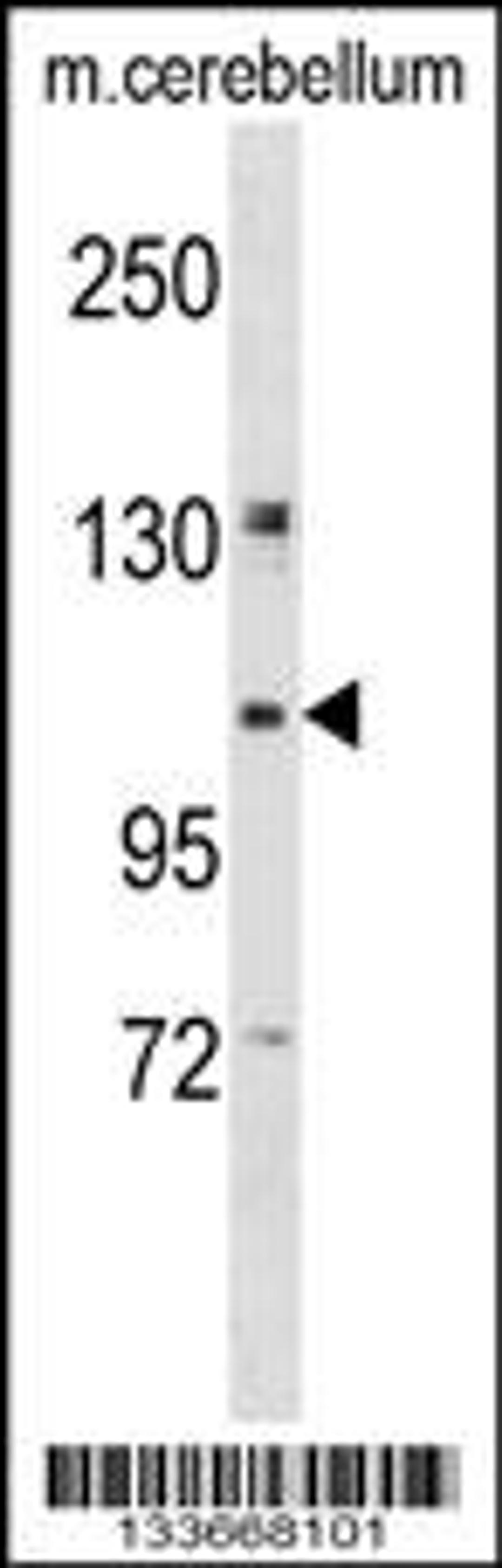 Western blot analysis in mouse cerebellum tissue lysates (35ug/lane).