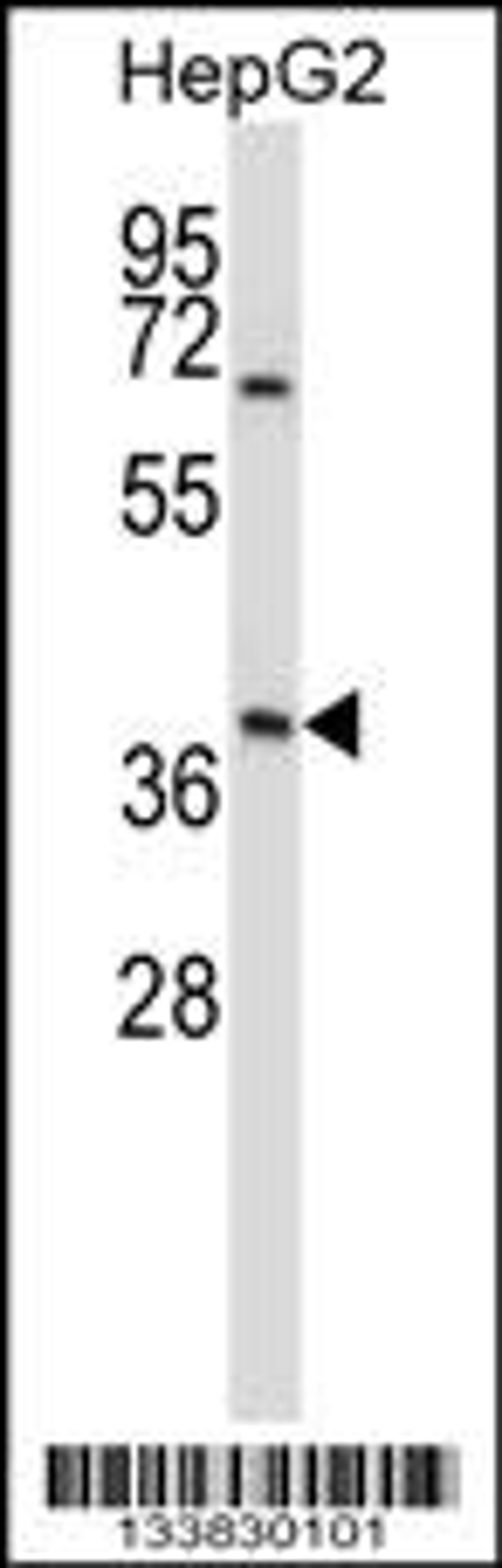 Western blot analysis in HepG2 cell line lysates (35ug/lane).