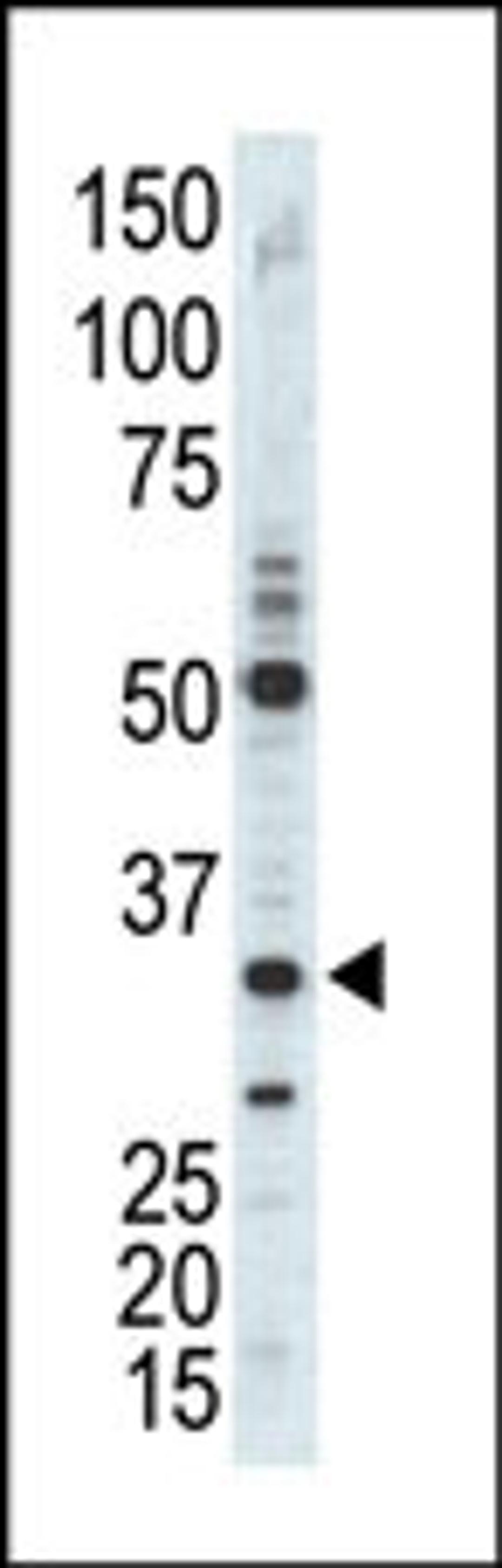 Western blot analysis of anti-CDK1 Pab in A375 cell lysate