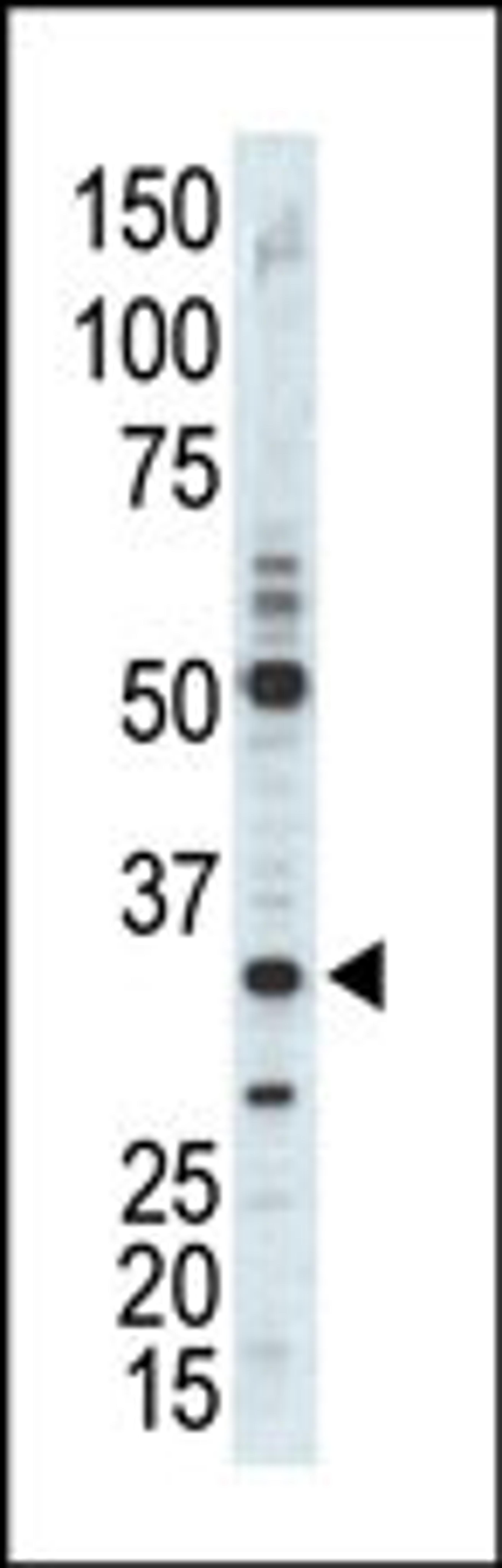 Western blot analysis of anti-CDK1 Pab in A375 cell lysate