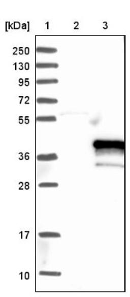 Western Blot: TNFAIP1 Antibody [NBP1-88931] - Lane 1: Marker [kDa] 250, 130, 95, 72, 55, 36, 28, 17, 10<br/>Lane 2: Negative control (vector only transfected HEK293T lysate)<br/>Lane 3: Over-expression lysate (Co-expressed with a C-terminal myc-DDK tag (~3.1 kDa) in mammalian HEK293T cells, LY412070)