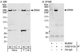 Detection of human and mouse DRIM by western blot (h&m) and immunoprecipitation (h).