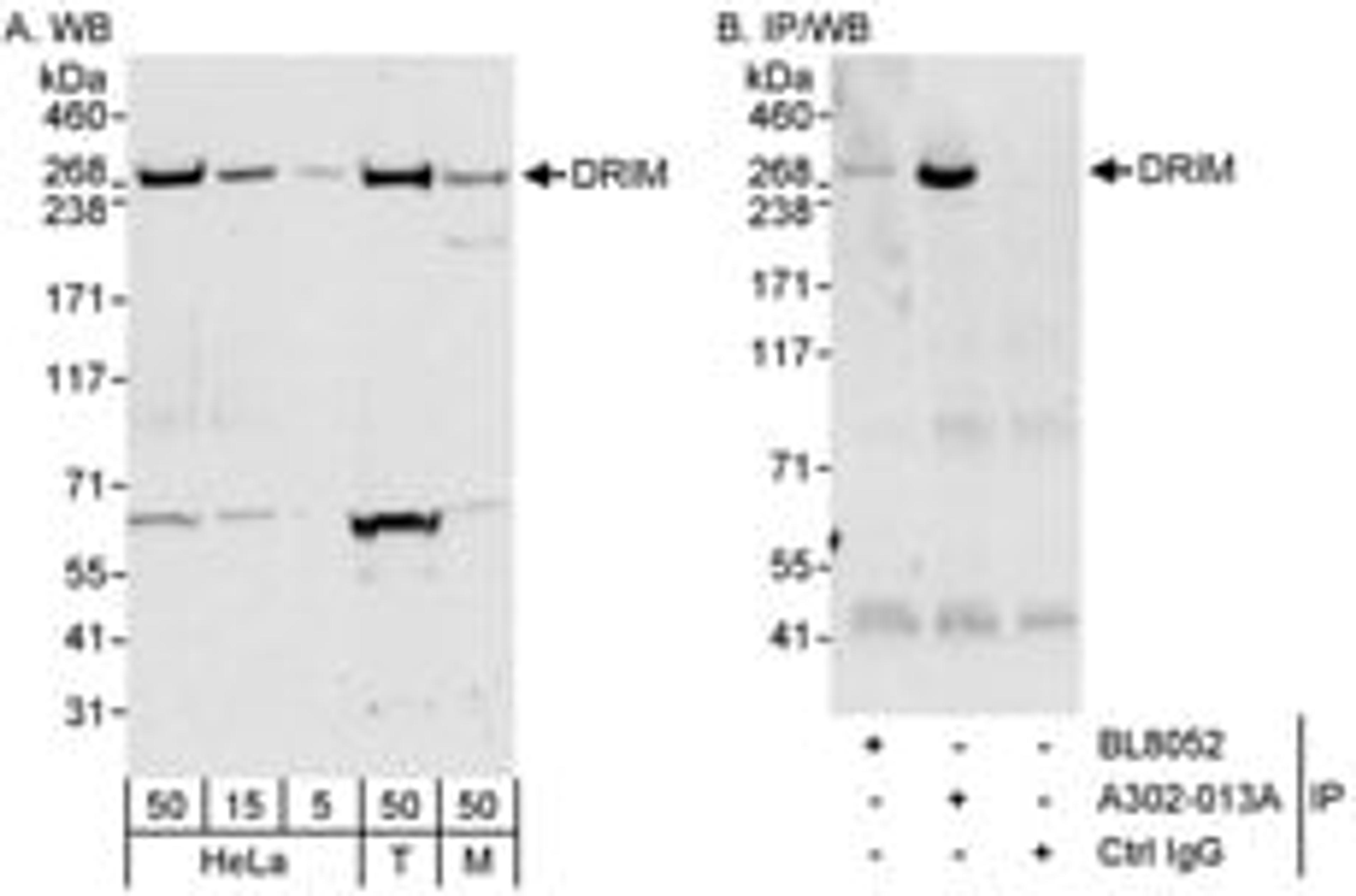 Detection of human and mouse DRIM by western blot (h&m) and immunoprecipitation (h).