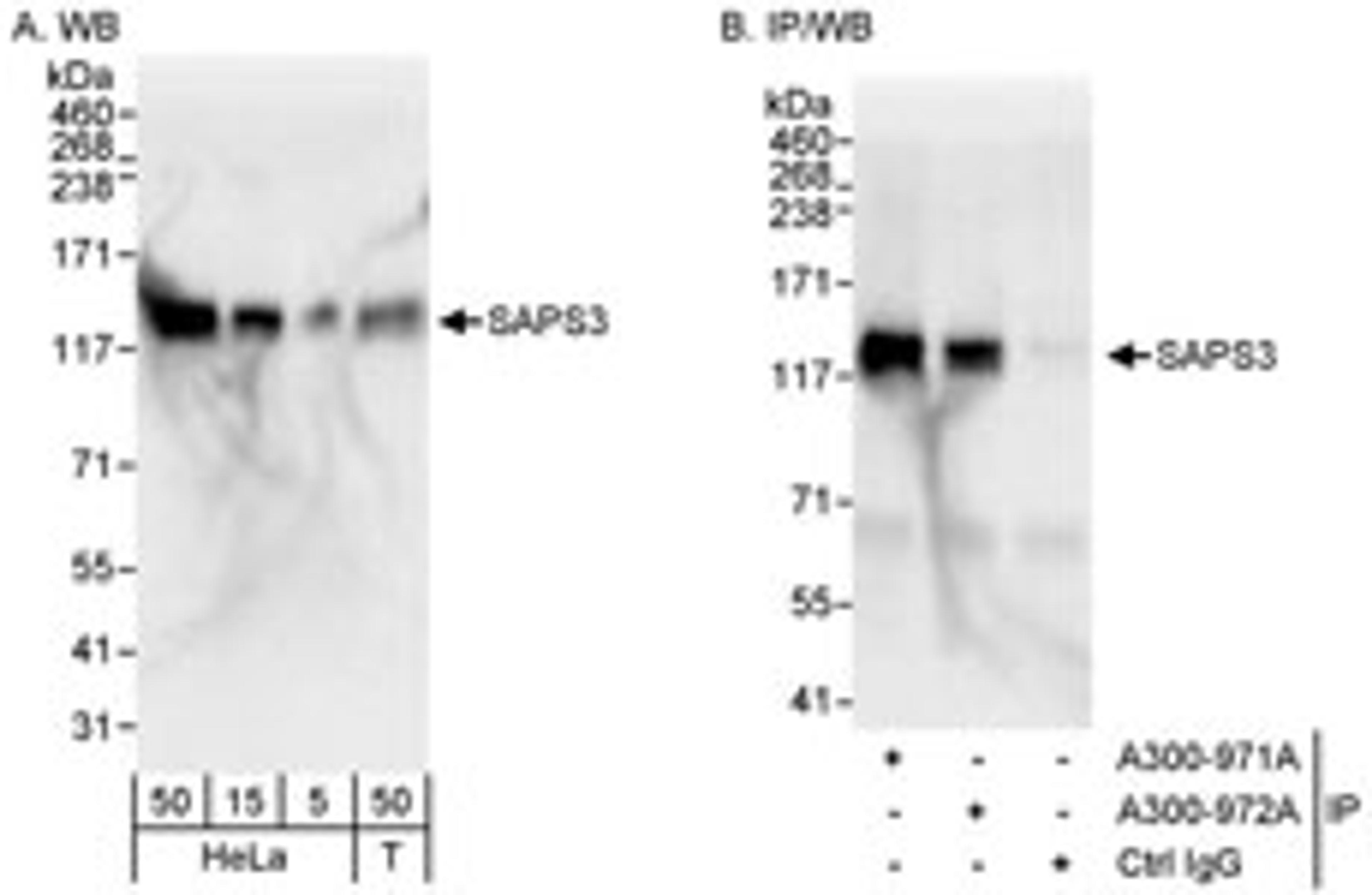 Detection of human SAPS3 by western blot and immunoprecipitation.