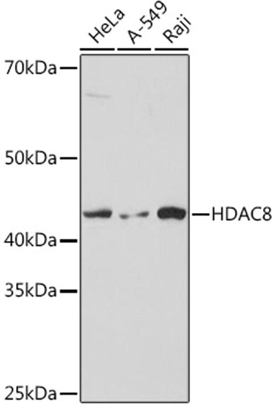 Western blot - HDAC8  Rabbit mAb (A8865)