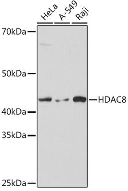 Western blot - HDAC8  Rabbit mAb (A8865)