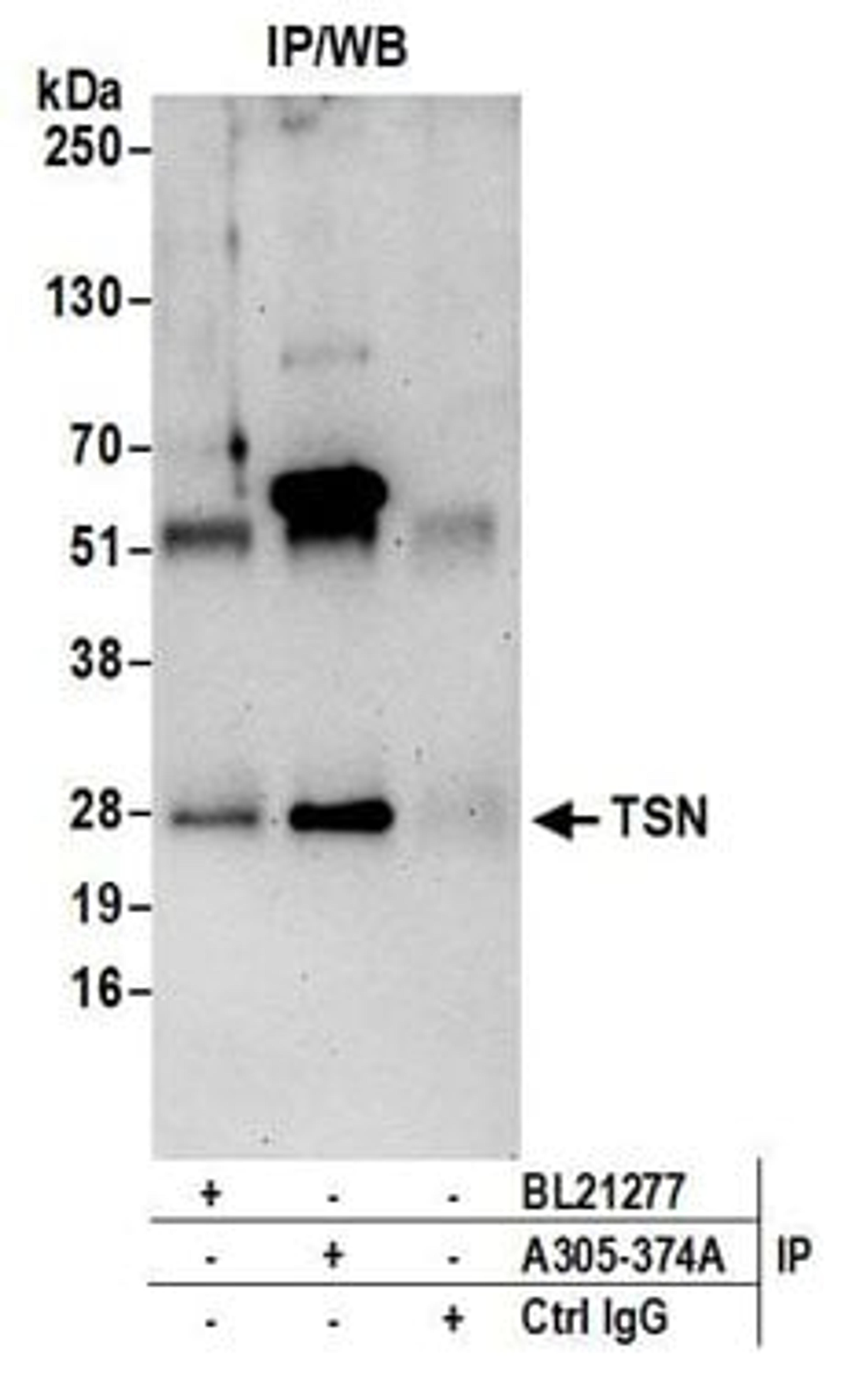 Detection of human TSN by western blot of immunoprecipitates.