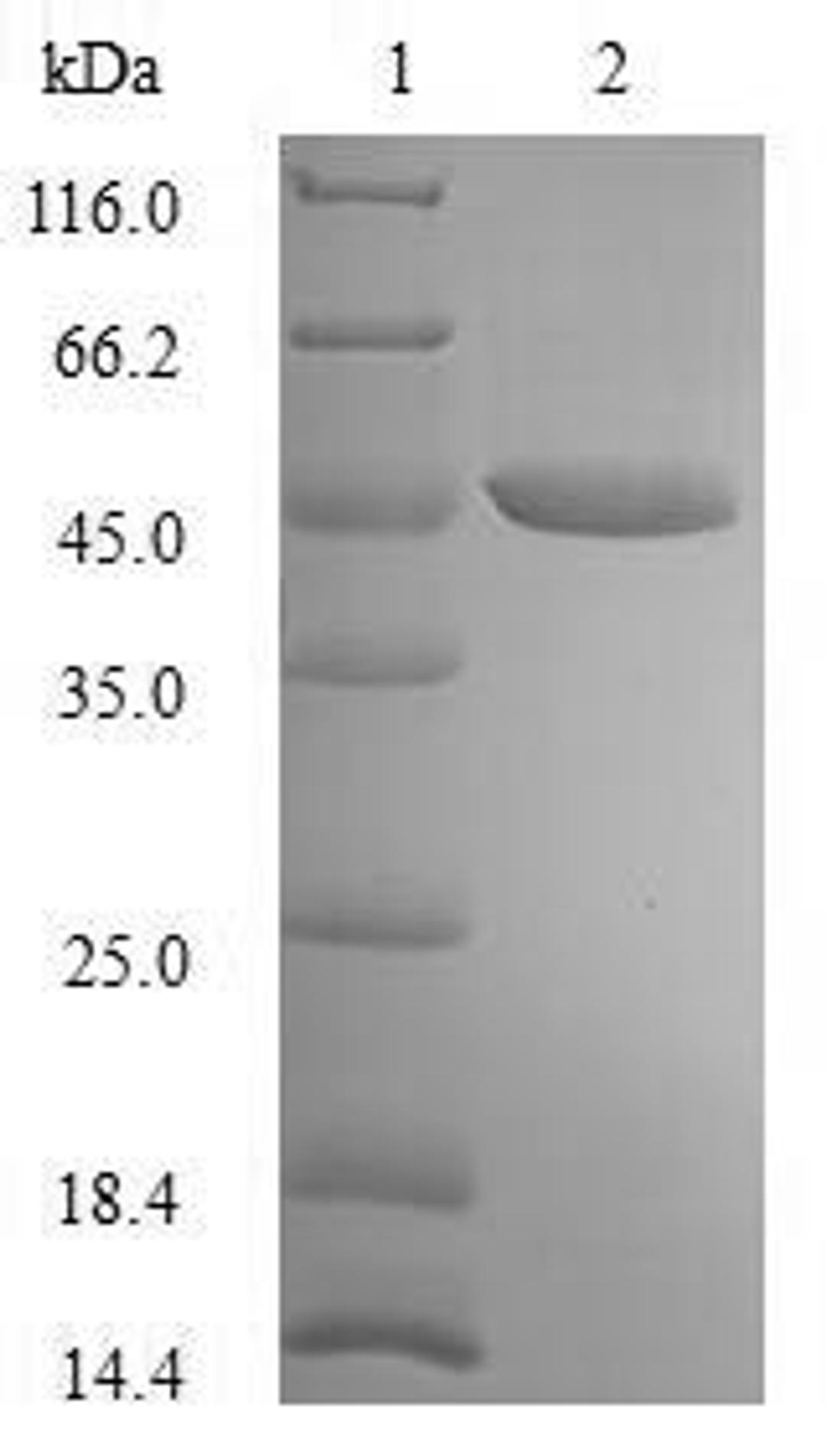 (Tris-Glycine gel) Discontinuous SDS-PAGE (reduced) with 5% enrichment gel and 15% separation gel.