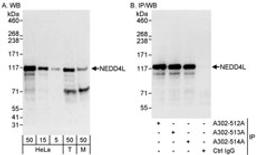 Detection of human and mouse NEDD4L by western blot (h&m) and immunoprecipitation (h).