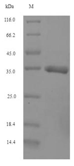 (Tris-Glycine gel) Discontinuous SDS-PAGE (reduced) with 5% enrichment gel and 15% separation gel.