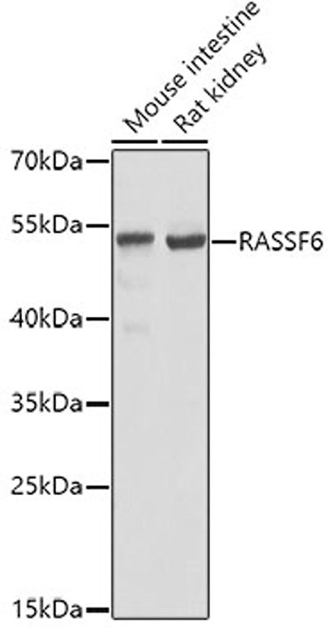 Western blot - RASSF6 antibody (A5187)