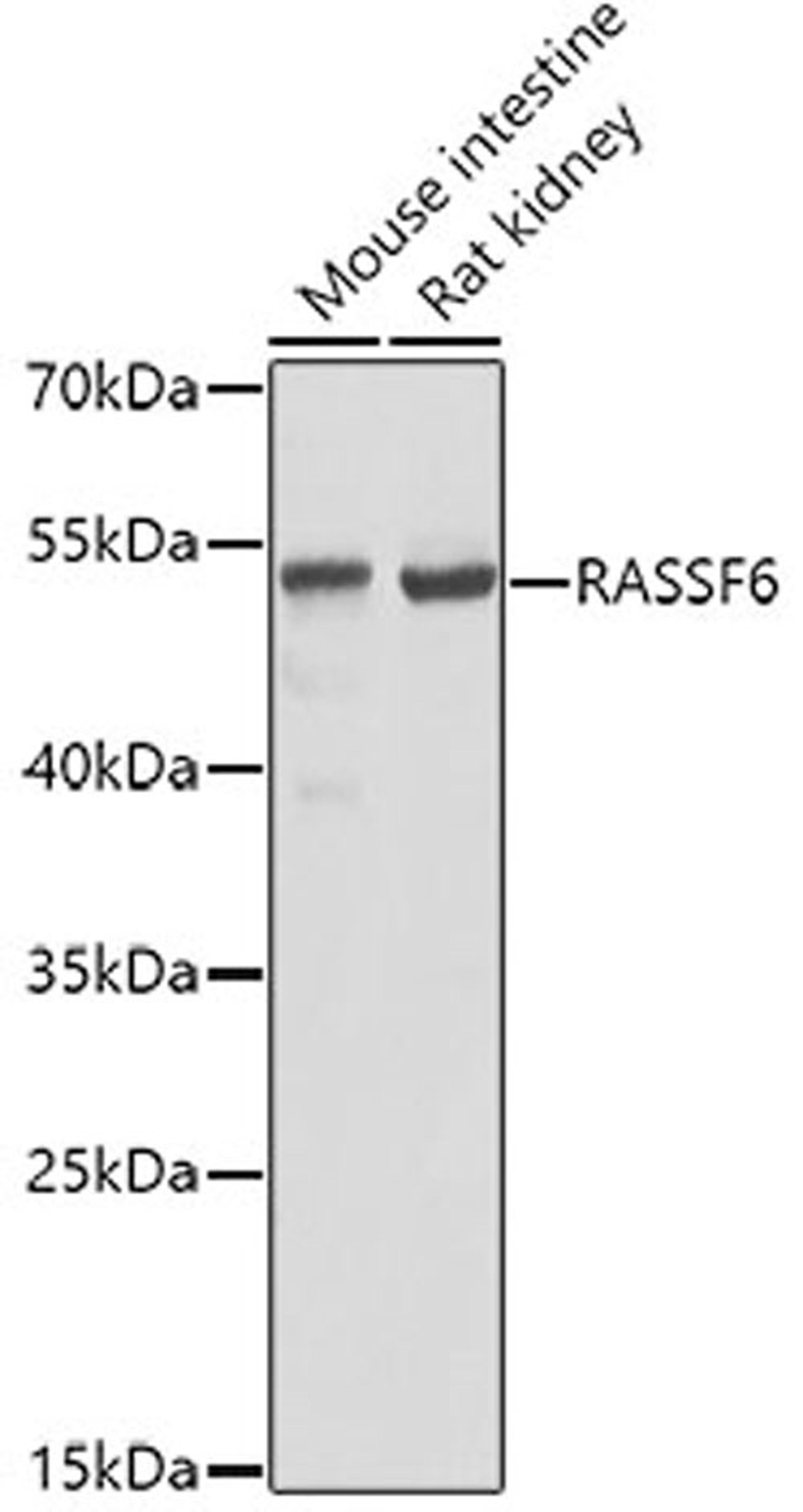 Western blot - RASSF6 antibody (A5187)