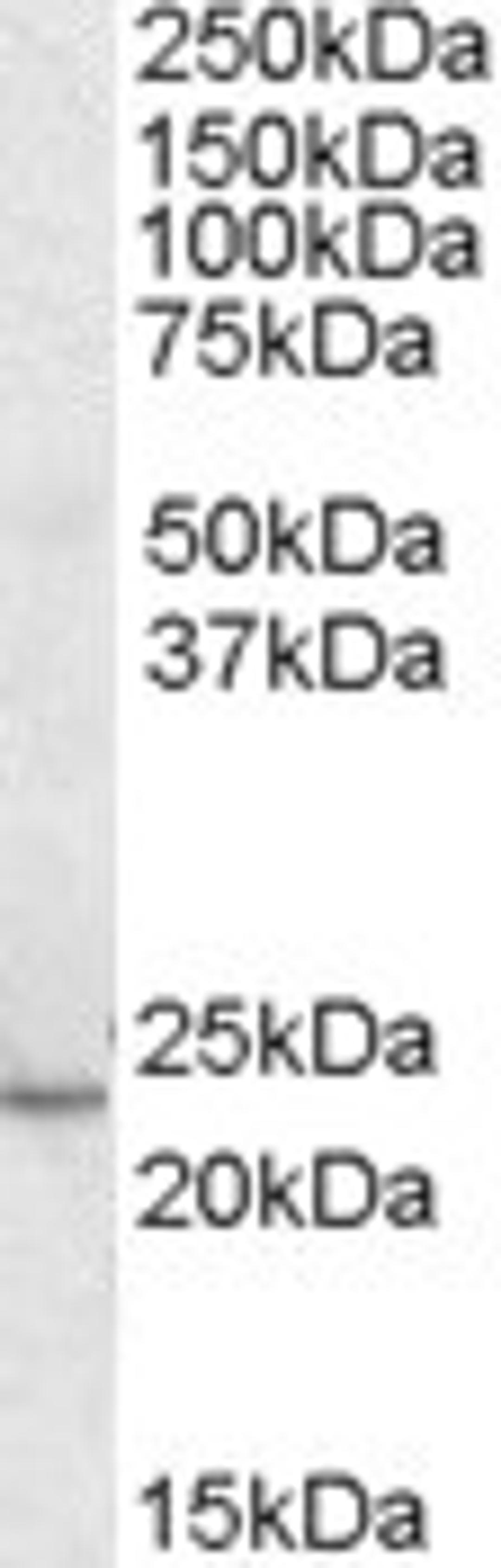 45-804 (0.3ug/ml) staining of Human Heart lysate (35ug protein in RIPA buffer). Primary incubation was 1 hour. Detected by chemiluminescence.