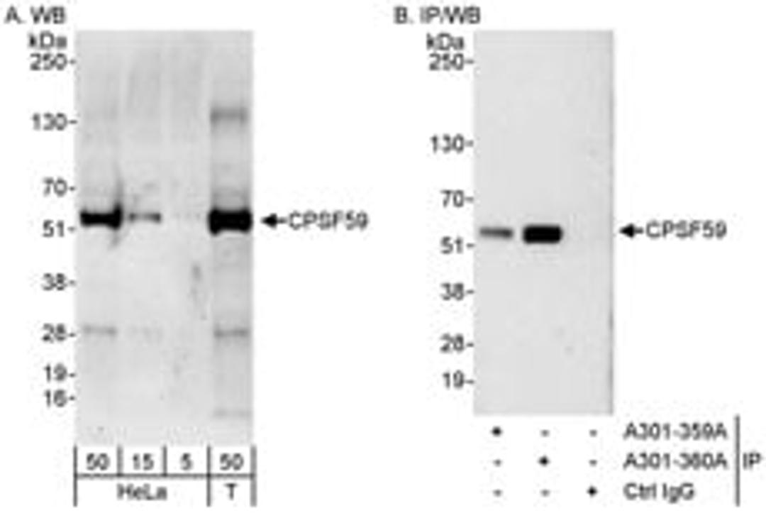 Detection of human CPSF59 by western blot and immunoprecipitation.