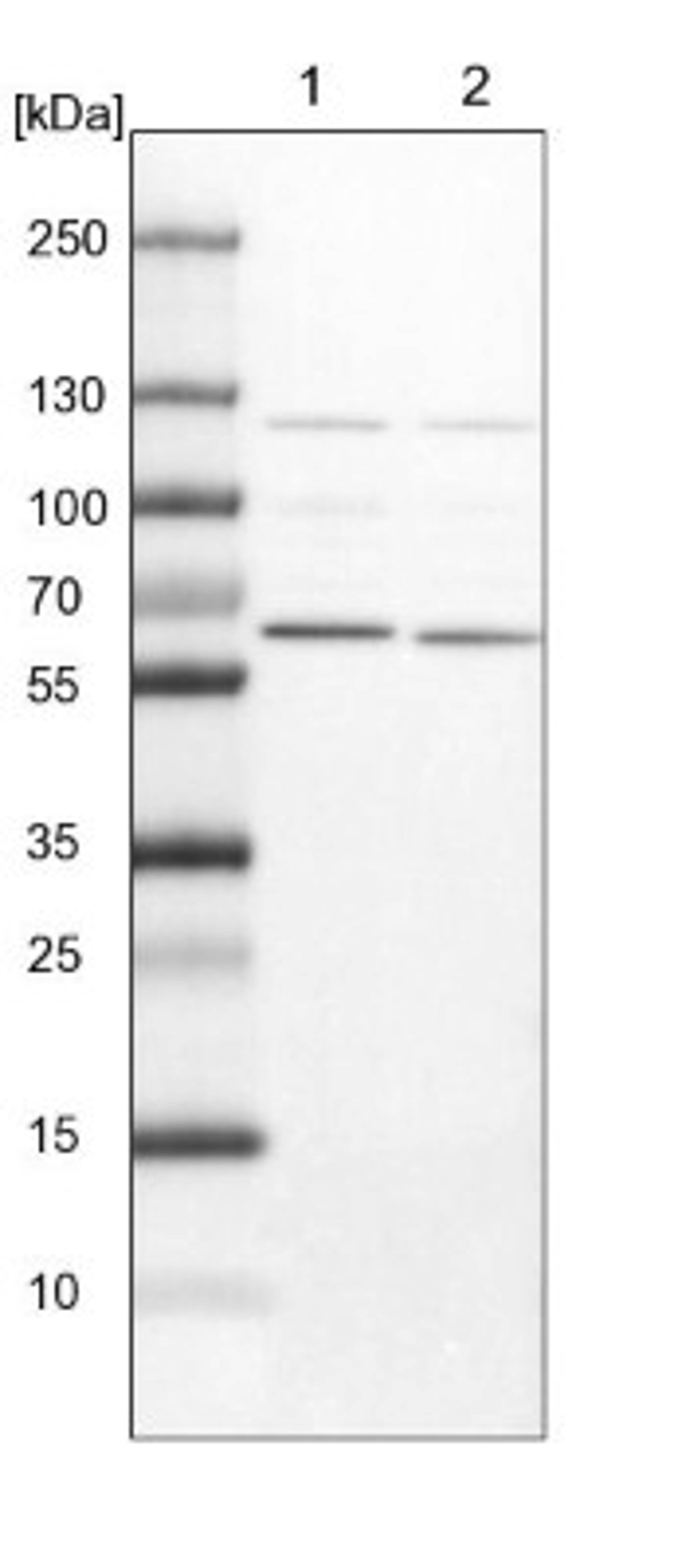 Western Blot: NULP1 Antibody [NBP1-92211] - Lane 1: NIH-3T3 cell lysate (Mouse embryonic fibroblast cells)<br/>Lane 2: NBT-II cell lysate (Rat Wistar bladder tumour cells)