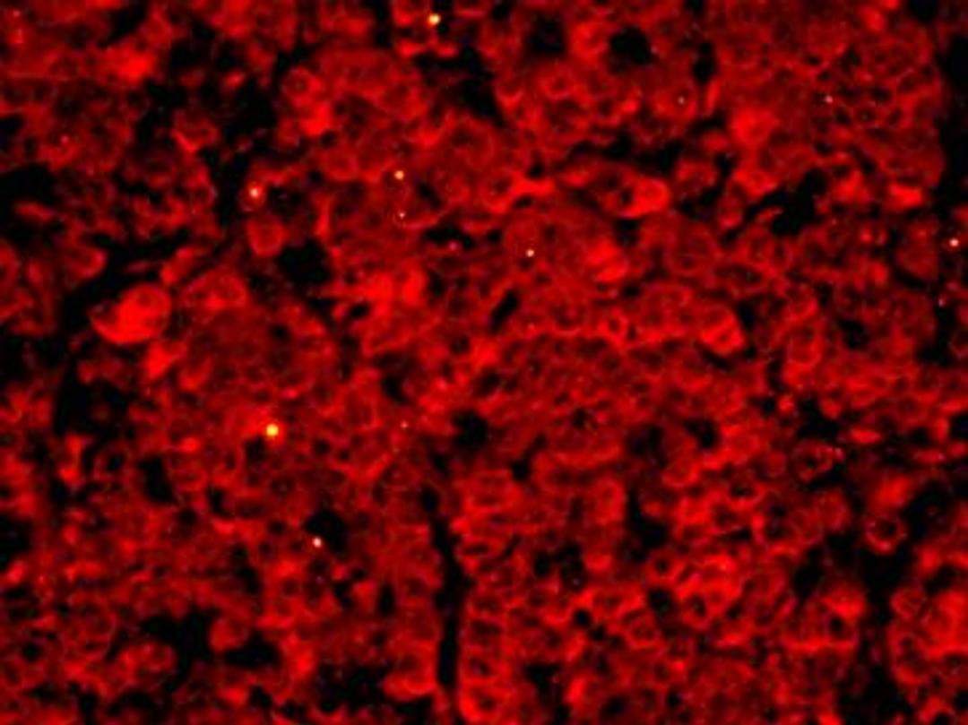 Immunoflurocence analysis of human lung carcinoma cells using MLK3 (phospho-Thr277/Ser281) antibody