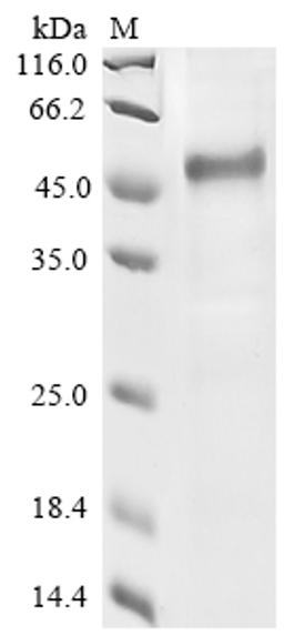 (Tris-Glycine gel) Discontinuous SDS-PAGE (reduced) with 5% enrichment gel and 15% separation gel.