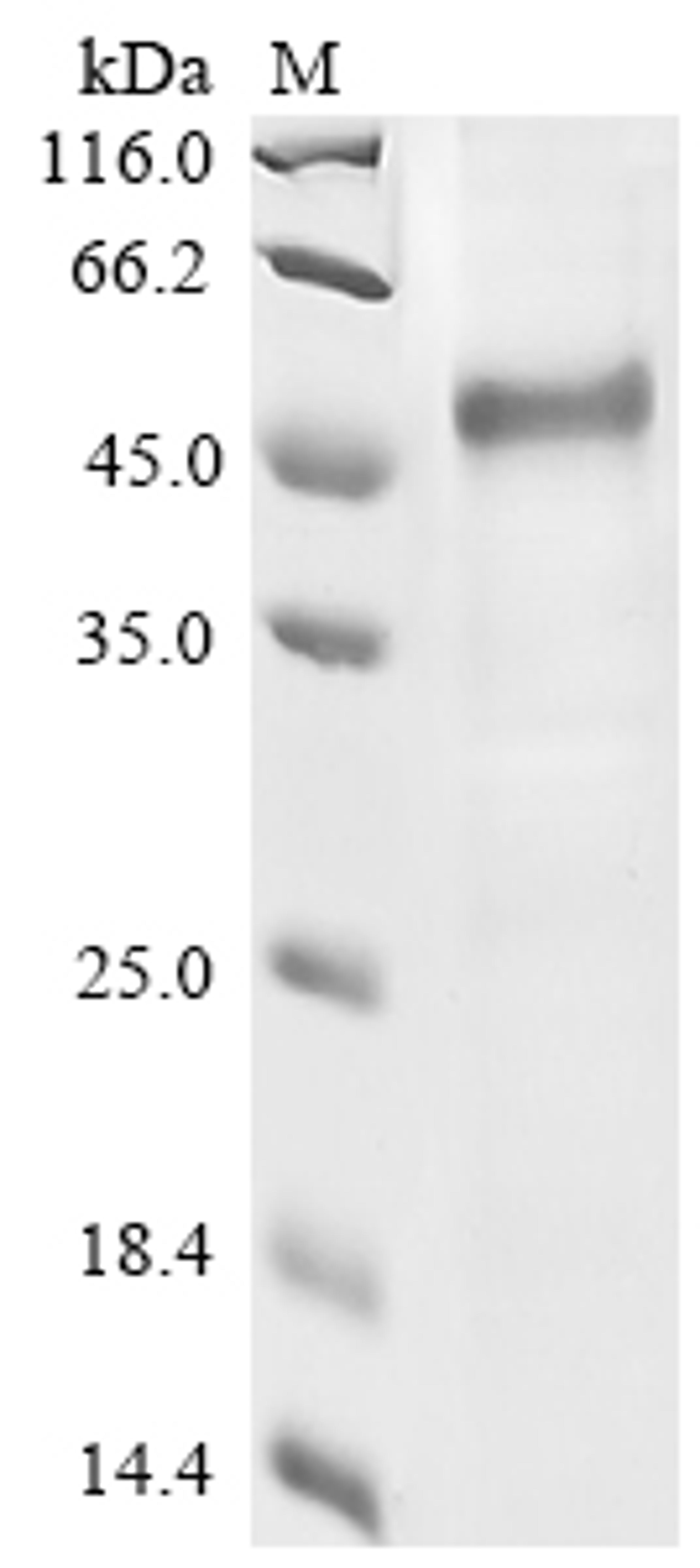 (Tris-Glycine gel) Discontinuous SDS-PAGE (reduced) with 5% enrichment gel and 15% separation gel.