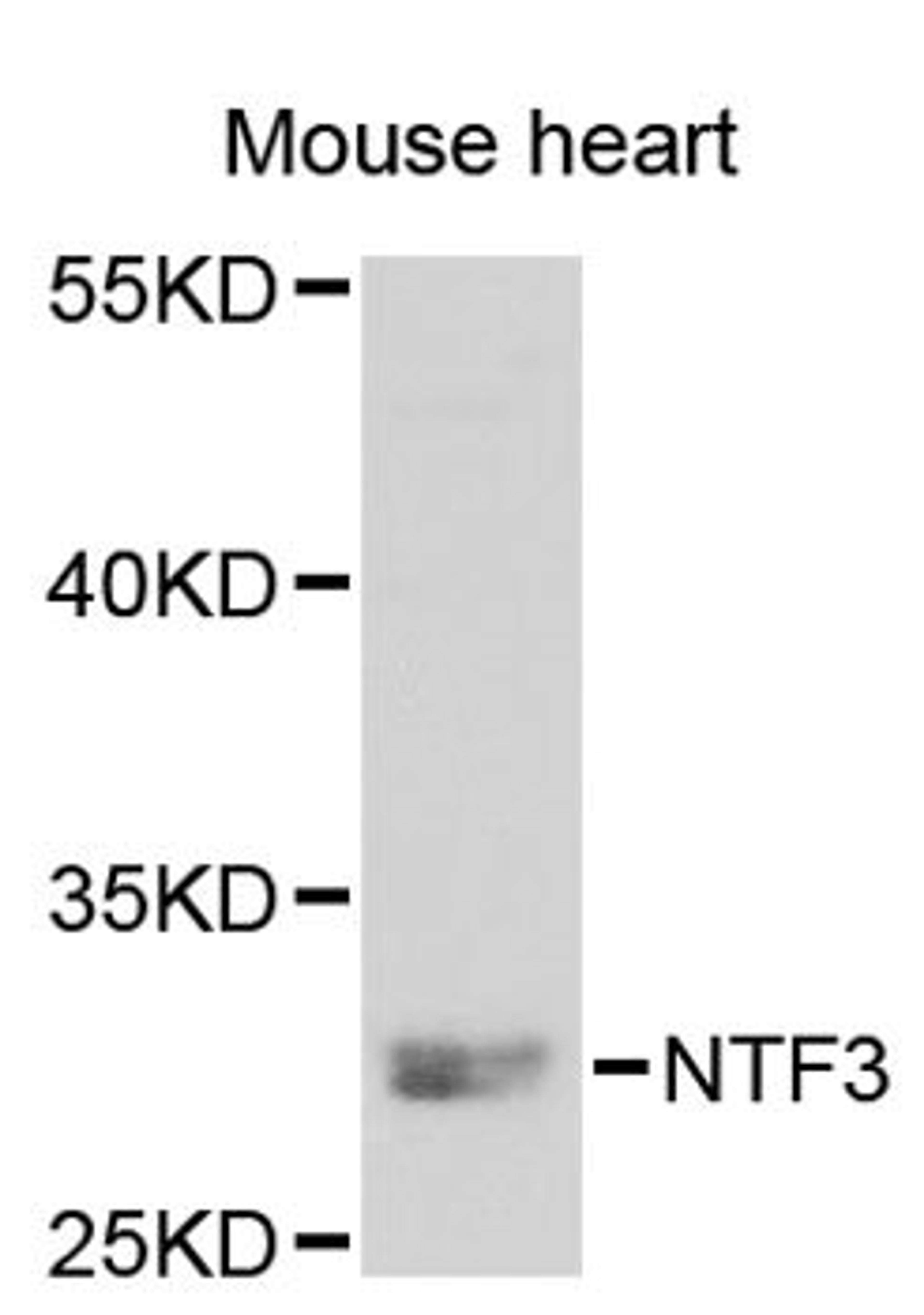 Western blot - NTF3 antibody (A3179)