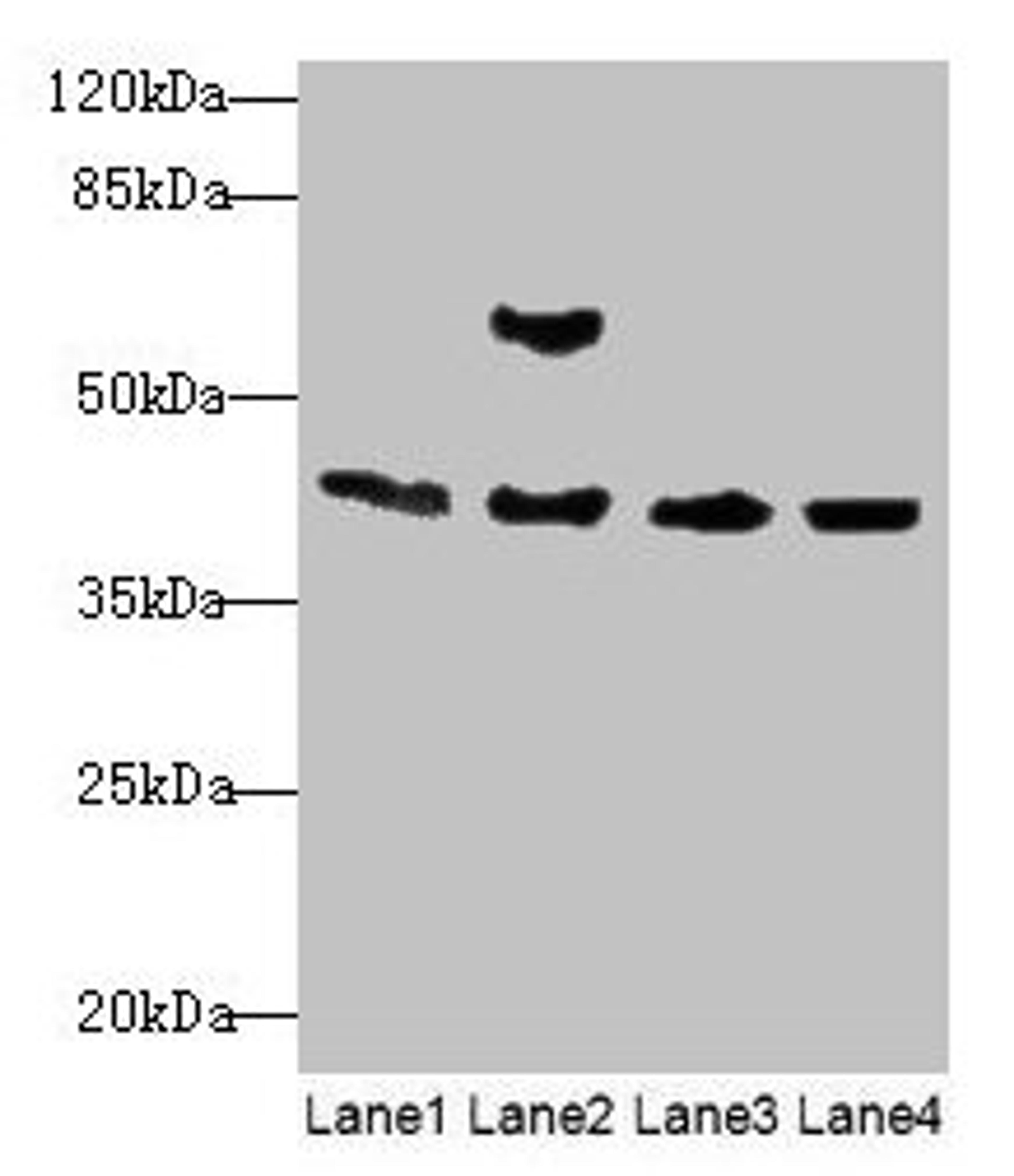 Western blot. All lanes: Acta1 antibody at 2µg/ml. Lane 1: Mouse brain tissue. Lane 2: Mouse lung tissue. Lane 3: Rat muscle tissue. Lane 4: Zebrafish lysate. Secondary. Goat polyclonal to rabbit IgG at 1/10000 dilution. Predicted band size: 43 kDa. Observed band size: 43 kDa