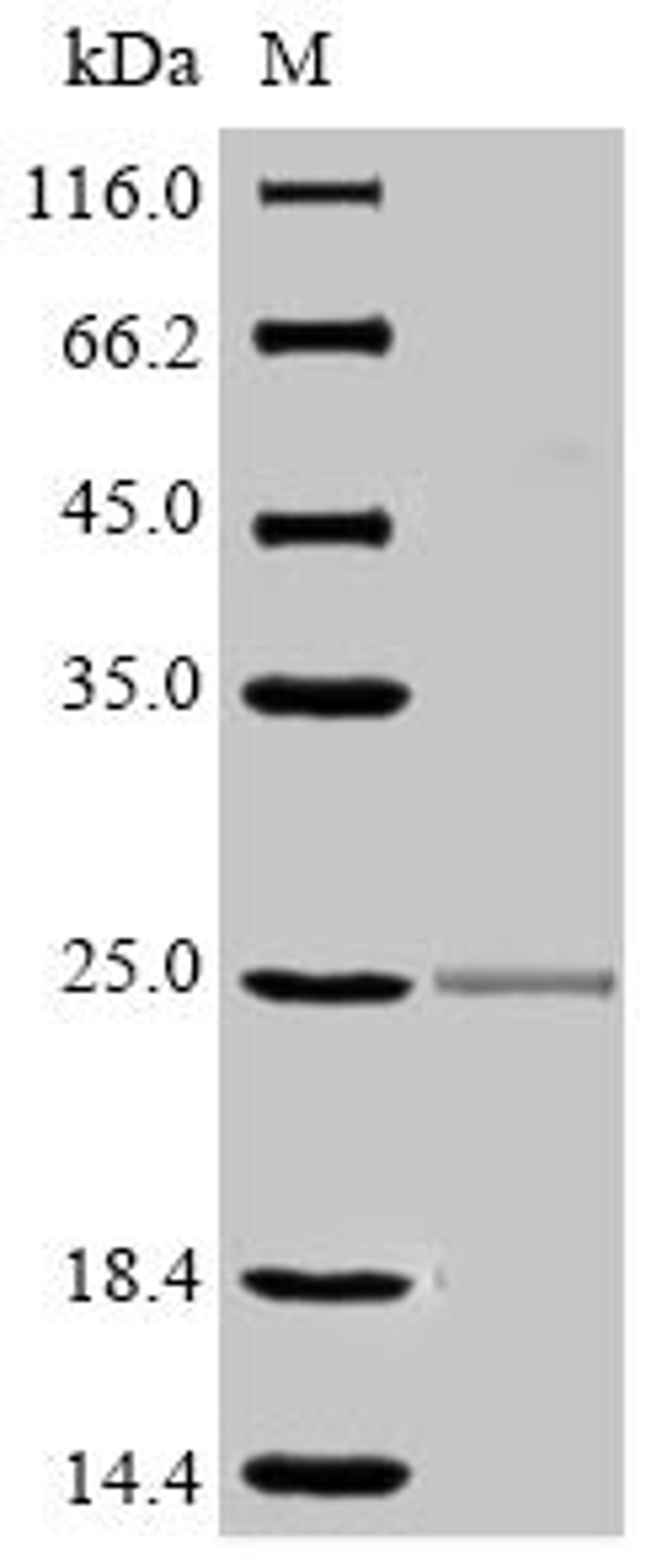 (Tris-Glycine gel) Discontinuous SDS-PAGE (reduced) with 5% enrichment gel and 15% separation gel.