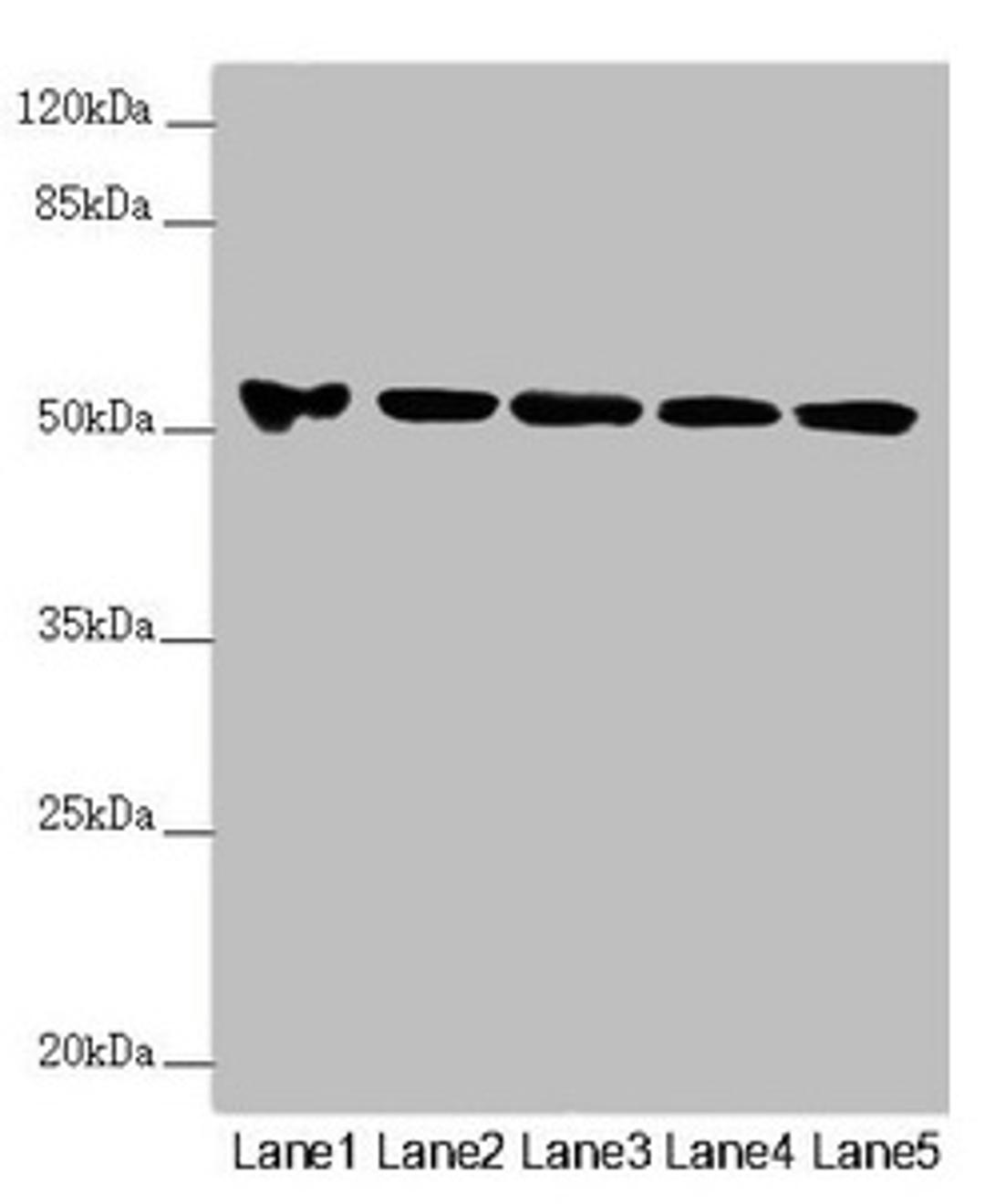 Western blot. All lanes: FOXRED1 antibody at 5.8µg/ml. Lane 1: A549 whole cell lysate. Lane 2: A431 whole cell lysate. Lane 3: Jurkat whole cell lysate. Lane 4: Hela whole cell lysate. Lane 5: HepG2 whole cell lysate. Secondary. Goat polyclonal to rabbit IgG at 1/10000 dilution. Predicted band size: 54, 31, 53 kDa. Observed band size: 54 kDa