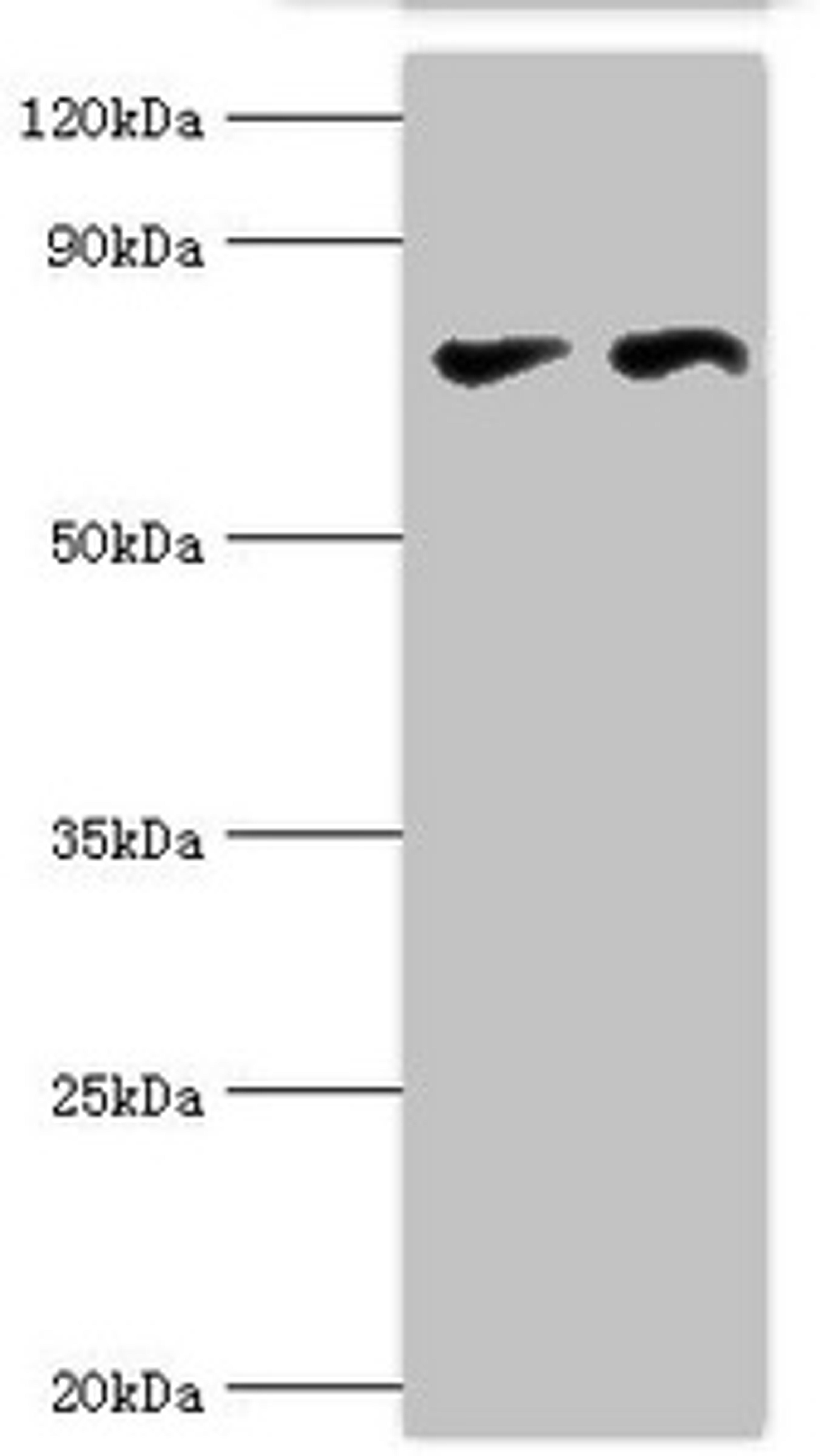 Western blot. All lanes: Transcriptional repressor CTCF antibody at 6ug/ml. Lane 1: PC-3 whole cell lysate. Lane 2: MCF-7 whole cell lysate. Secondary. Goat polyclonal to rabbit IgG at 1/10000 dilution. Predicted band size: 83, 46 kDa. Observed band size: 83 kDa.