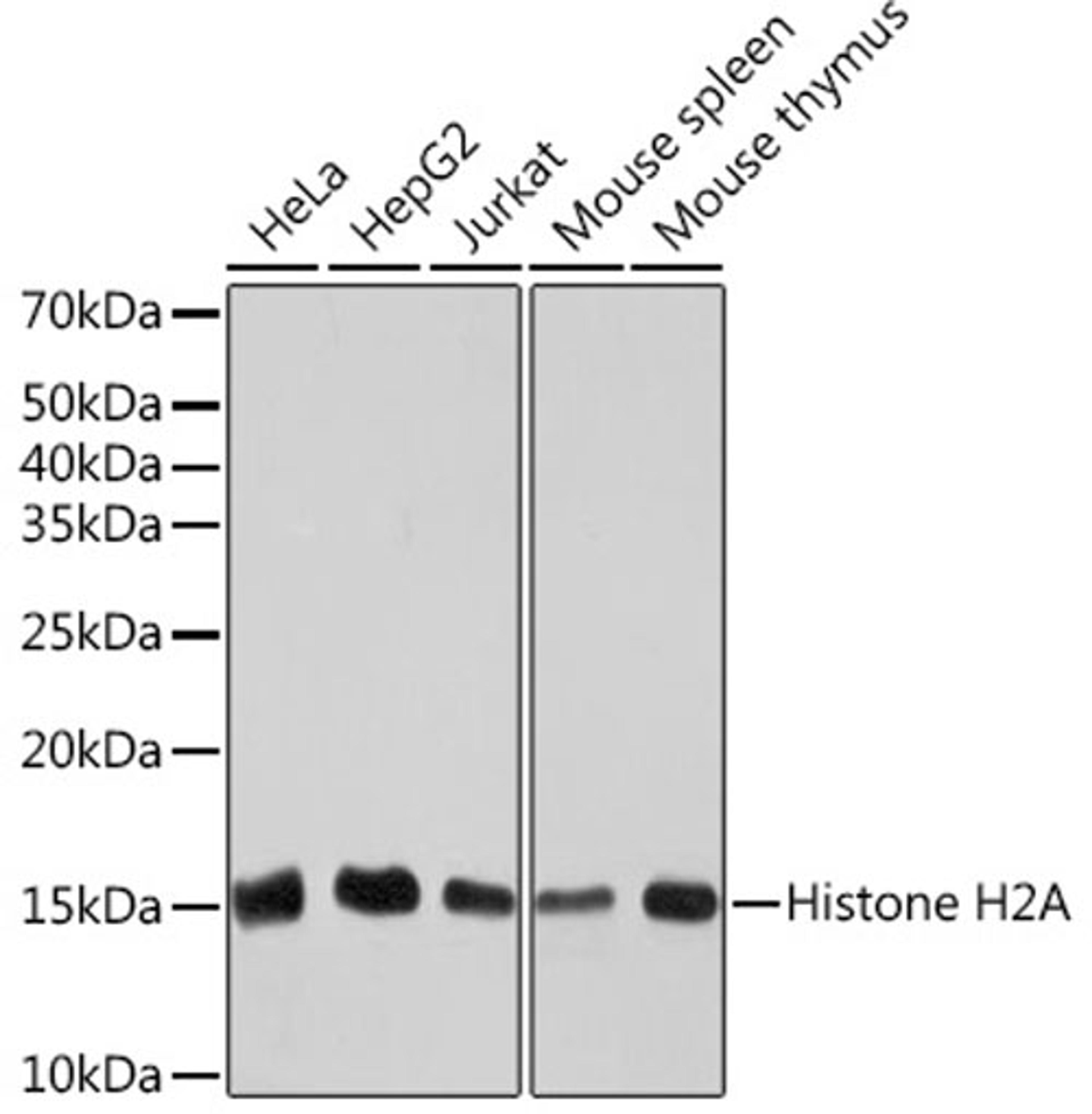 Western blot - Histone H2A Rabbit mAb (A3692)