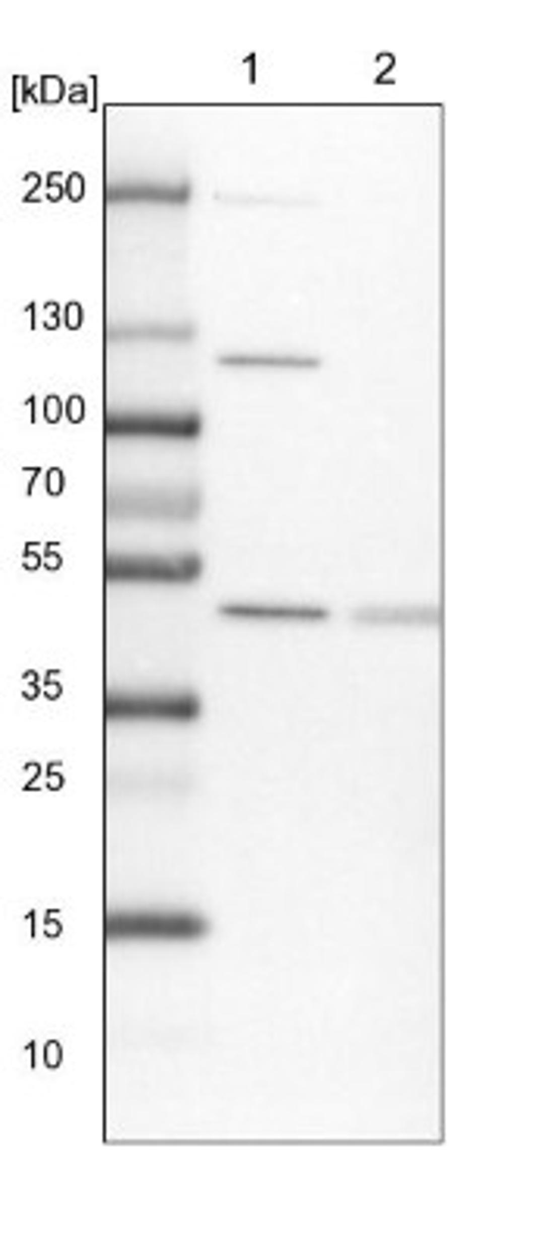 Western Blot: GAS8 Antibody [NBP2-14037] - Lane 1: NIH-3T3 cell lysate (Mouse embryonic fibroblast cells)<br/>Lane 2: NBT-II cell lysate (Rat Wistar bladder tumour cells)