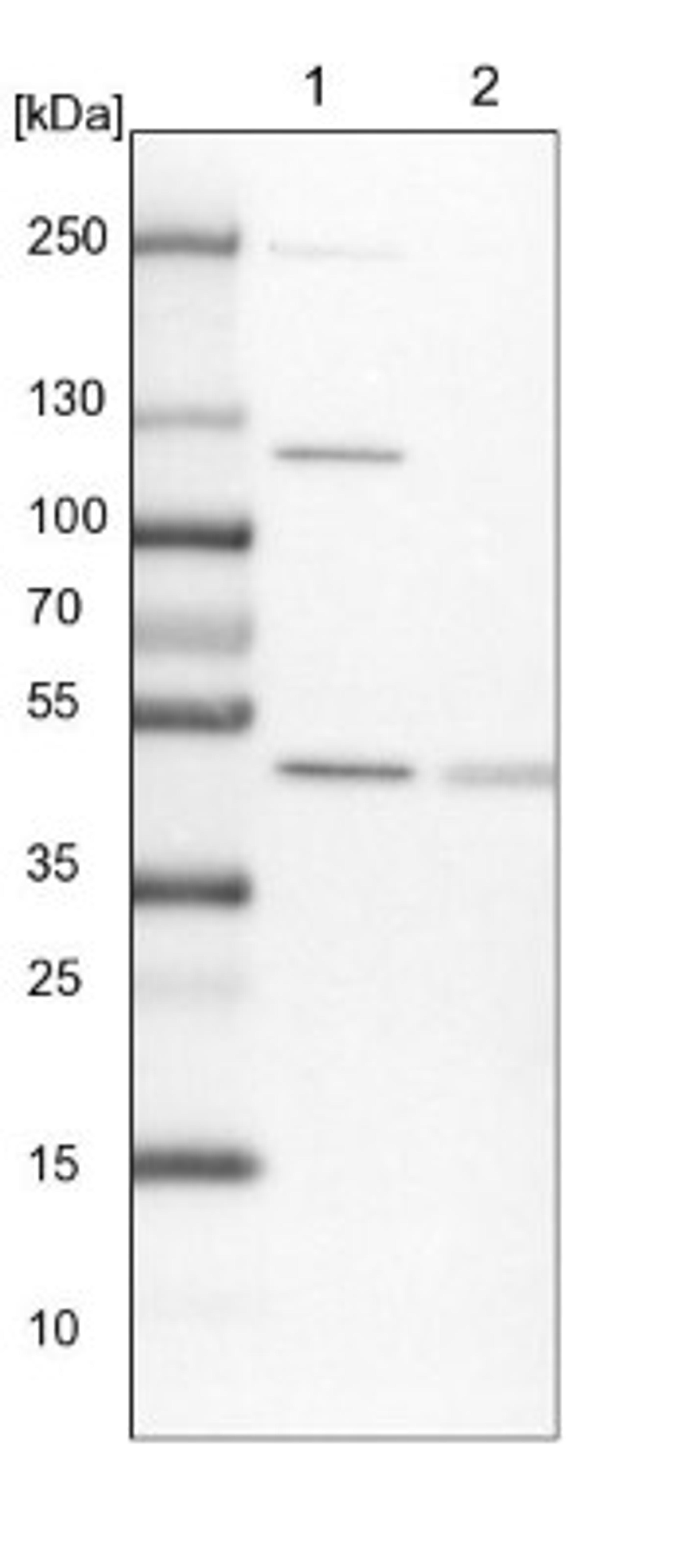 Western Blot: GAS8 Antibody [NBP2-14037] - Lane 1: NIH-3T3 cell lysate (Mouse embryonic fibroblast cells)<br/>Lane 2: NBT-II cell lysate (Rat Wistar bladder tumour cells)