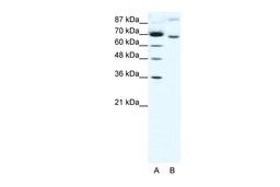 Antibody used in WB on Human HepG2 at 1.25 ug/ml.