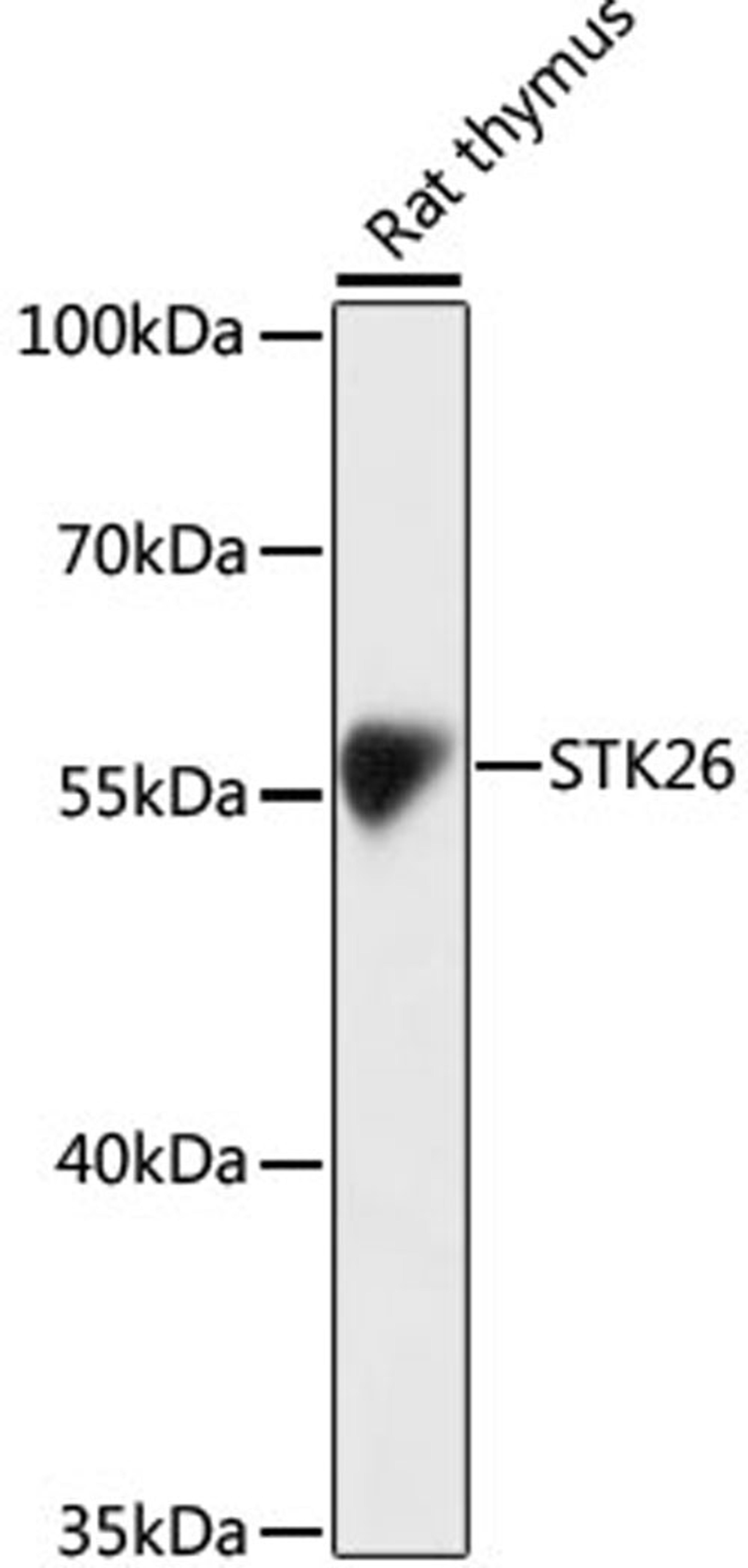 Western blot - STK26 antibody (A16534)