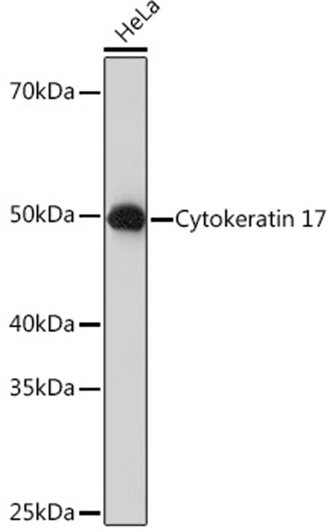 Western blot - Cytokeratin 17 Rabbit mAb (A3769)