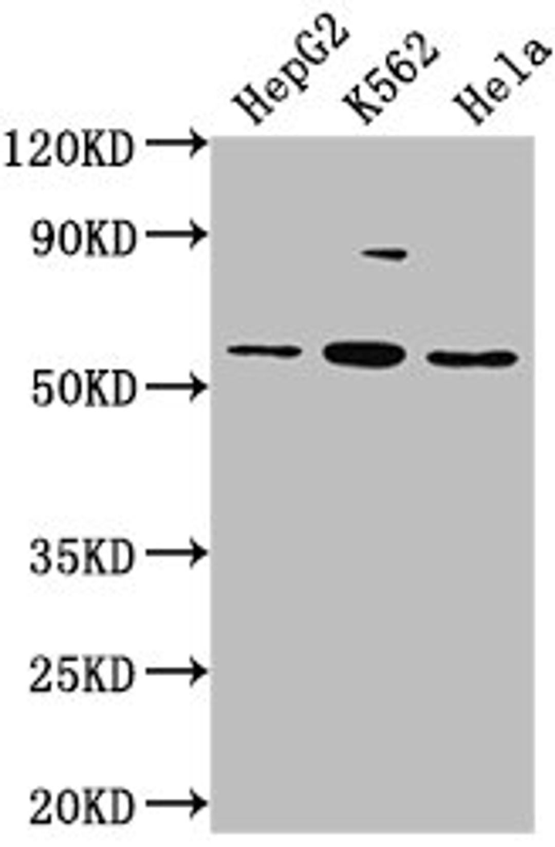 Western Blot. Positive WB detected in: HepG2 whole cell lysate, K562 whole cell lysate, Hela whole cell lysate. All lanes: ADRA1A antibody at 1:2000. Secondary. Goat polyclonal to rabbit IgG at 1/50000 dilution. Predicted band size: 52, 53, 48, 51, 33, 38, 36, 41 kDa. Observed band size: 52 kDa.