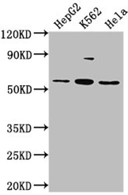 Western Blot. Positive WB detected in: HepG2 whole cell lysate, K562 whole cell lysate, Hela whole cell lysate. All lanes: ADRA1A antibody at 1:2000. Secondary. Goat polyclonal to rabbit IgG at 1/50000 dilution. Predicted band size: 52, 53, 48, 51, 33, 38, 36, 41 kDa. Observed band size: 52 kDa.