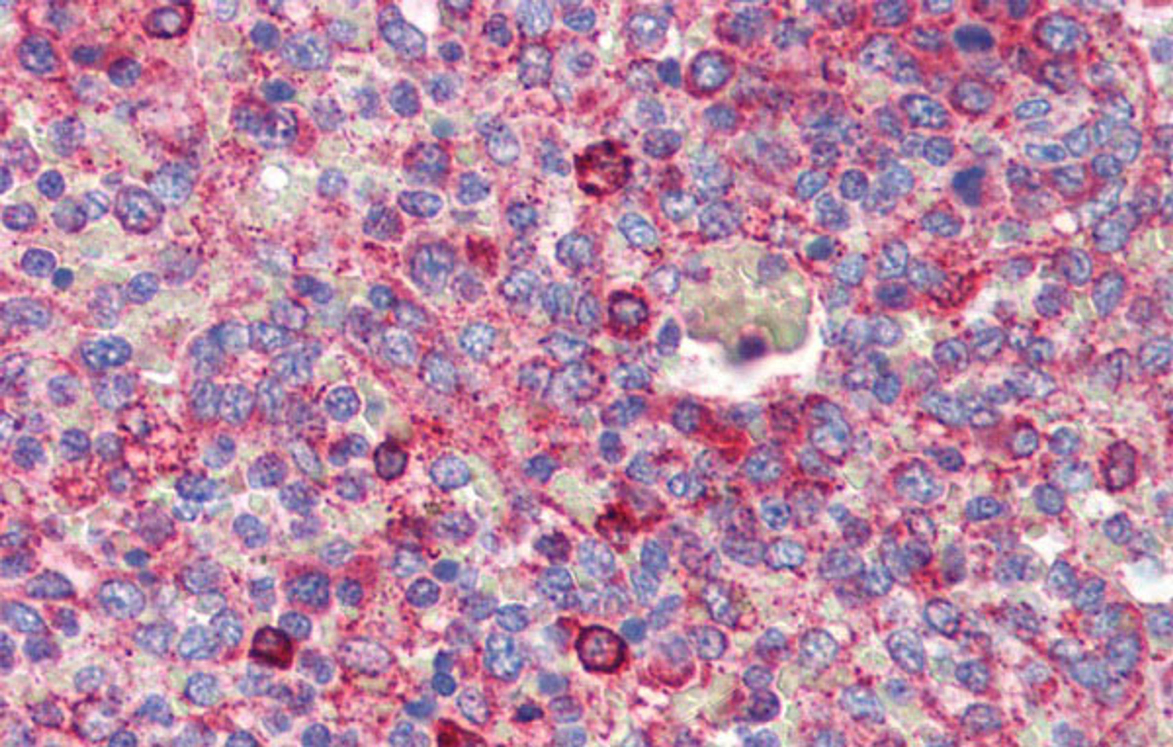 Antibody used in IHC on Human Spleen at 5.0 ug/ml.