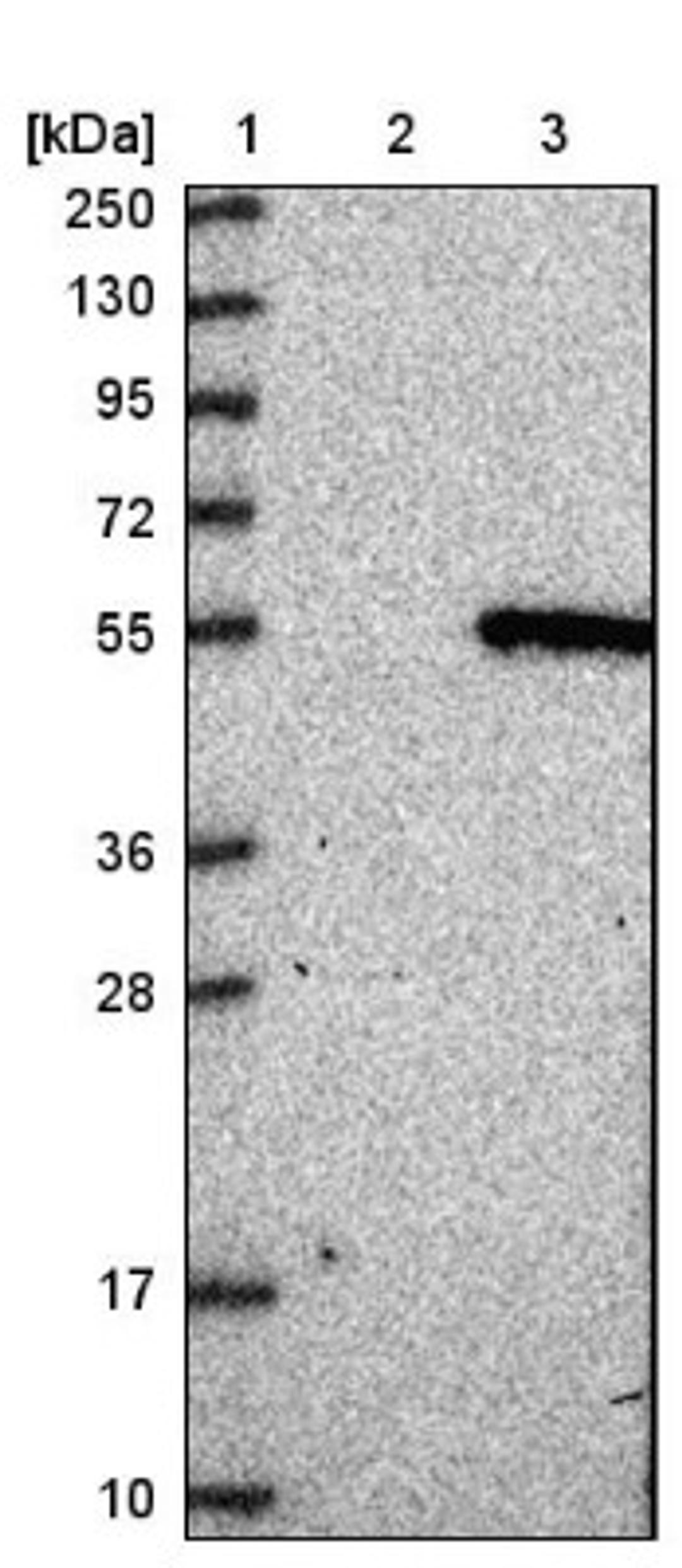 Western Blot: METTL18 Antibody [NBP1-88869] - Lane 1: Marker [kDa] 250, 130, 95, 72, 55, 36, 28, 17, 10<br/>Lane 2: Negative control (vector only transfected HEK293T lysate)<br/>Lane 3: Over-expression lysate (Co-expressed with a C-terminal myc-DDK tag (~3.1 kDa) in mammalian HEK293T cells, LY409543)