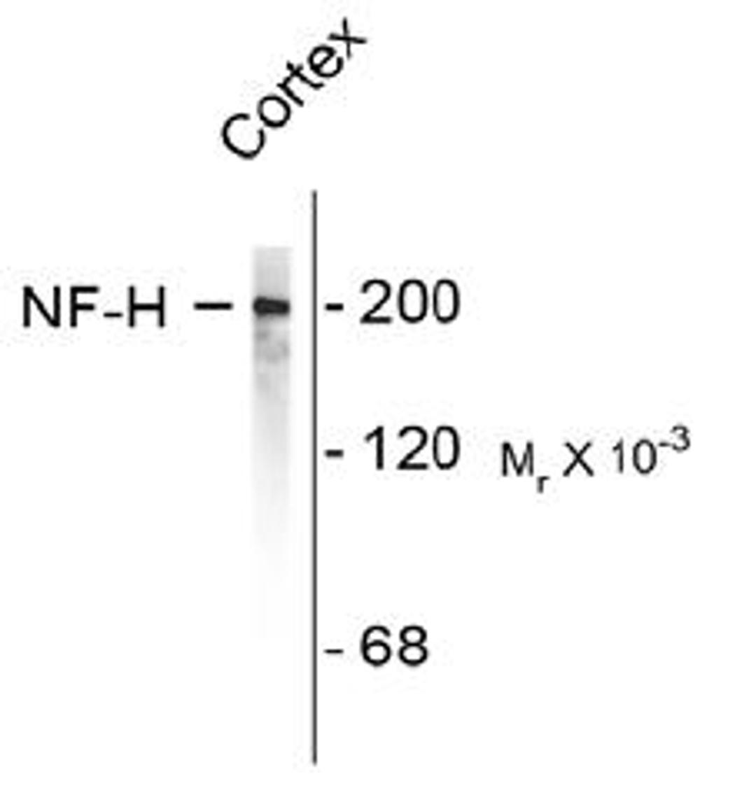 Western blot of rat cortex lysate showing specific immunolableing of the ~200k NF-H protein. <br><br> <b>Below:</b> Immunofluorescence of rat cortical neurons and glia showing NF-H staining (red).