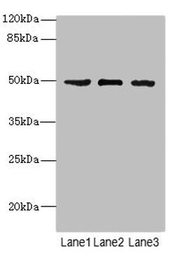Western blot. All lanes: CSNK1G1 antibody at 1.13µg/ml. Lane 1: Jurkat whole cell lysate. Lane 2: Hela whole cell lysate. Lane 3: MCF-7 whole cell lysate. Secondary. Goat polyclonal to rabbit IgG at 1/10000 dilution. Predicted band size: 49, 46 kDa. Observed band size: 49 kDa