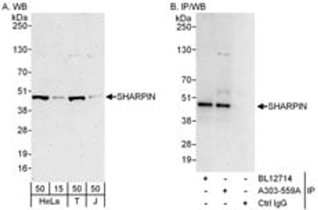 Detection of human SHARPIN by western blot and immunoprecipitation.