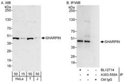 Detection of human SHARPIN by western blot and immunoprecipitation.