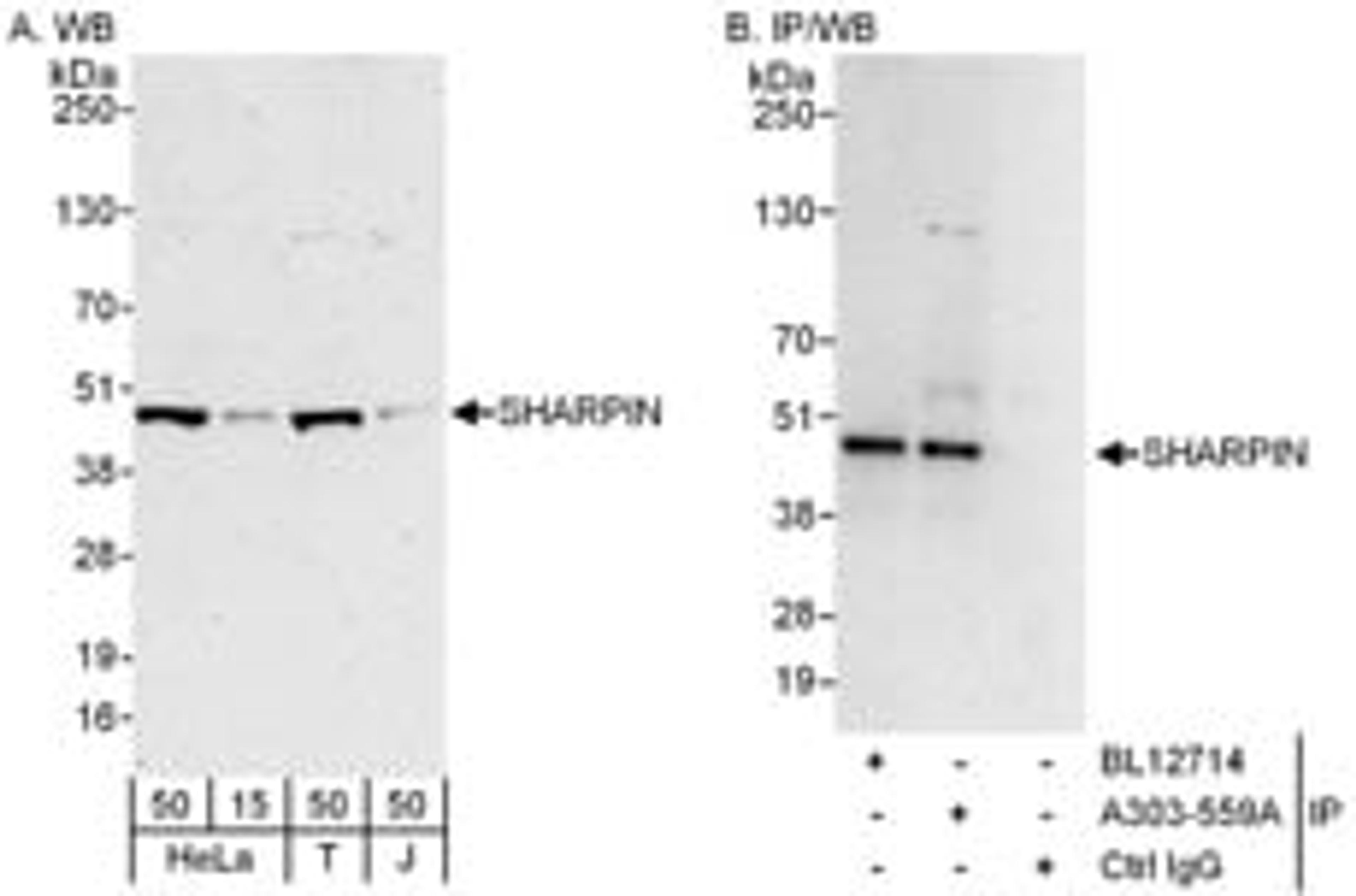 Detection of human SHARPIN by western blot and immunoprecipitation.