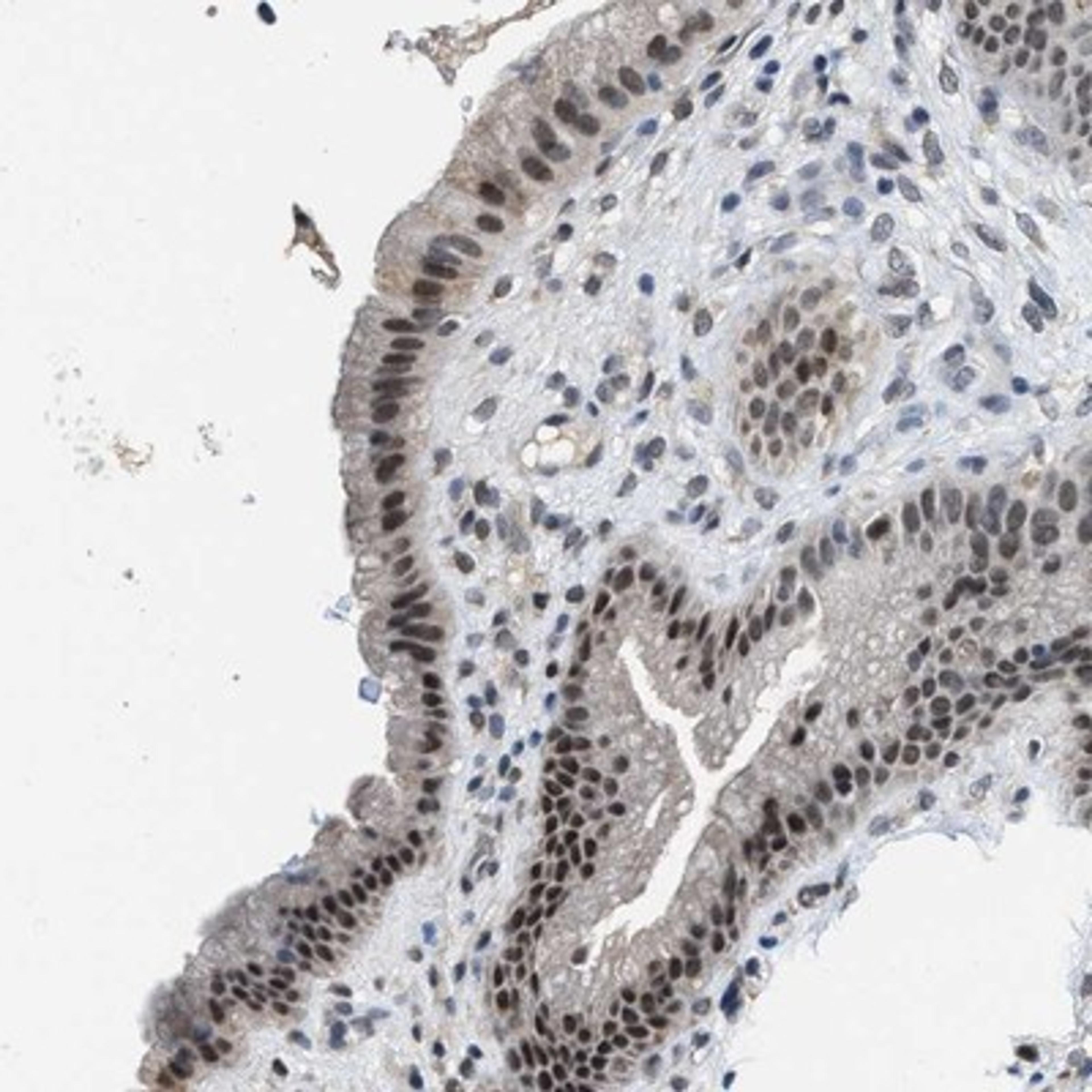 Immunohistochemistry-Paraffin: KIF24 Antibody [NBP1-90781] - Staining of human gall bladder shows strong nuclear positivity in glandular cells.