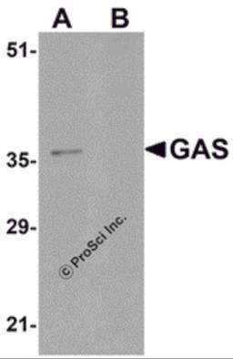 Western blot analysis of GAS in EL4 cell lysate in (A) the absence and (B) the presence of blocking peptide with GAS antibody at 1&#956;g/mL.