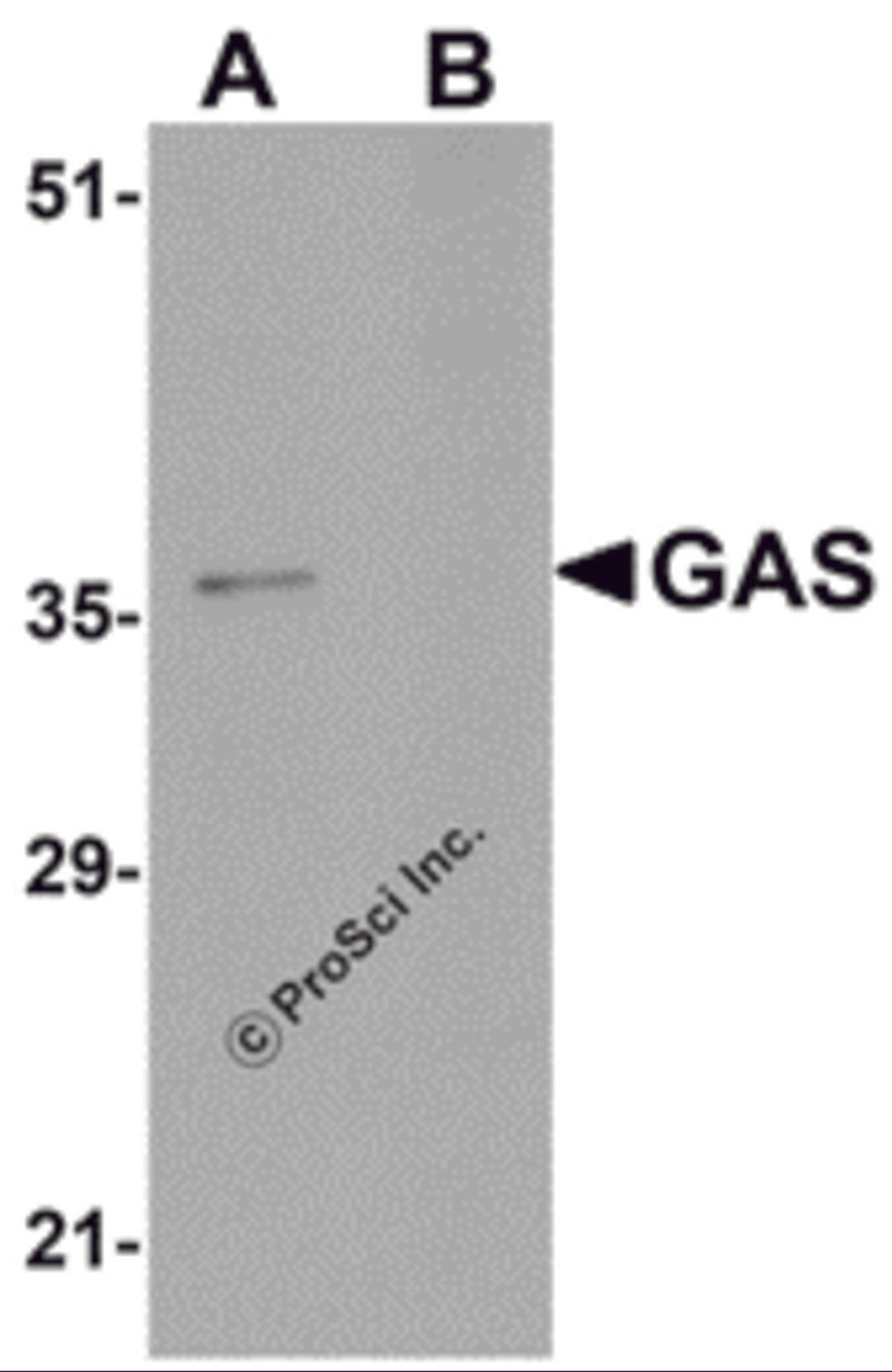 Western blot analysis of GAS in EL4 cell lysate in (A) the absence and (B) the presence of blocking peptide with GAS antibody at 1μg/mL.