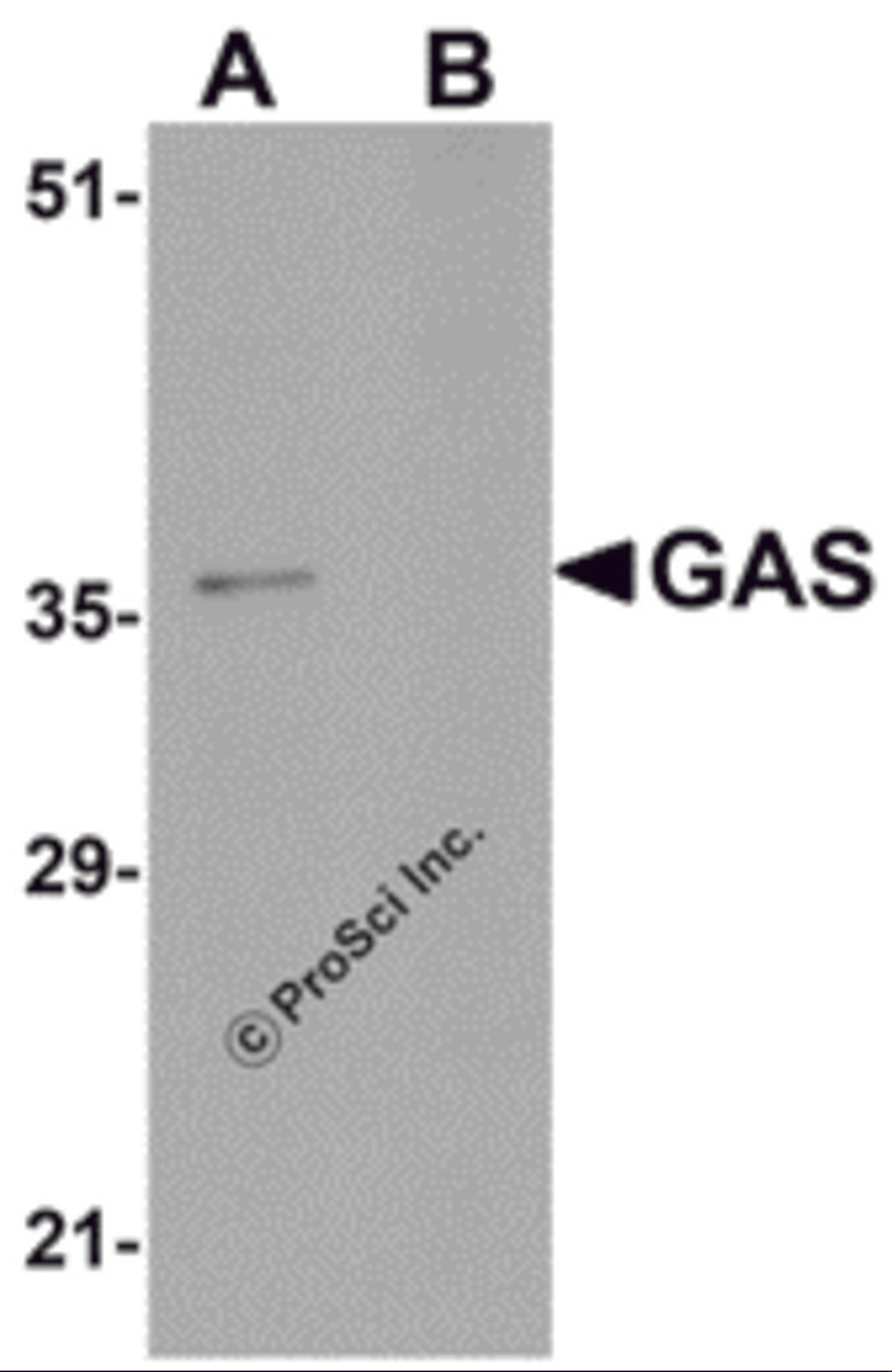 Western blot analysis of GAS in EL4 cell lysate in (A) the absence and (B) the presence of blocking peptide with GAS antibody at 1μg/mL.