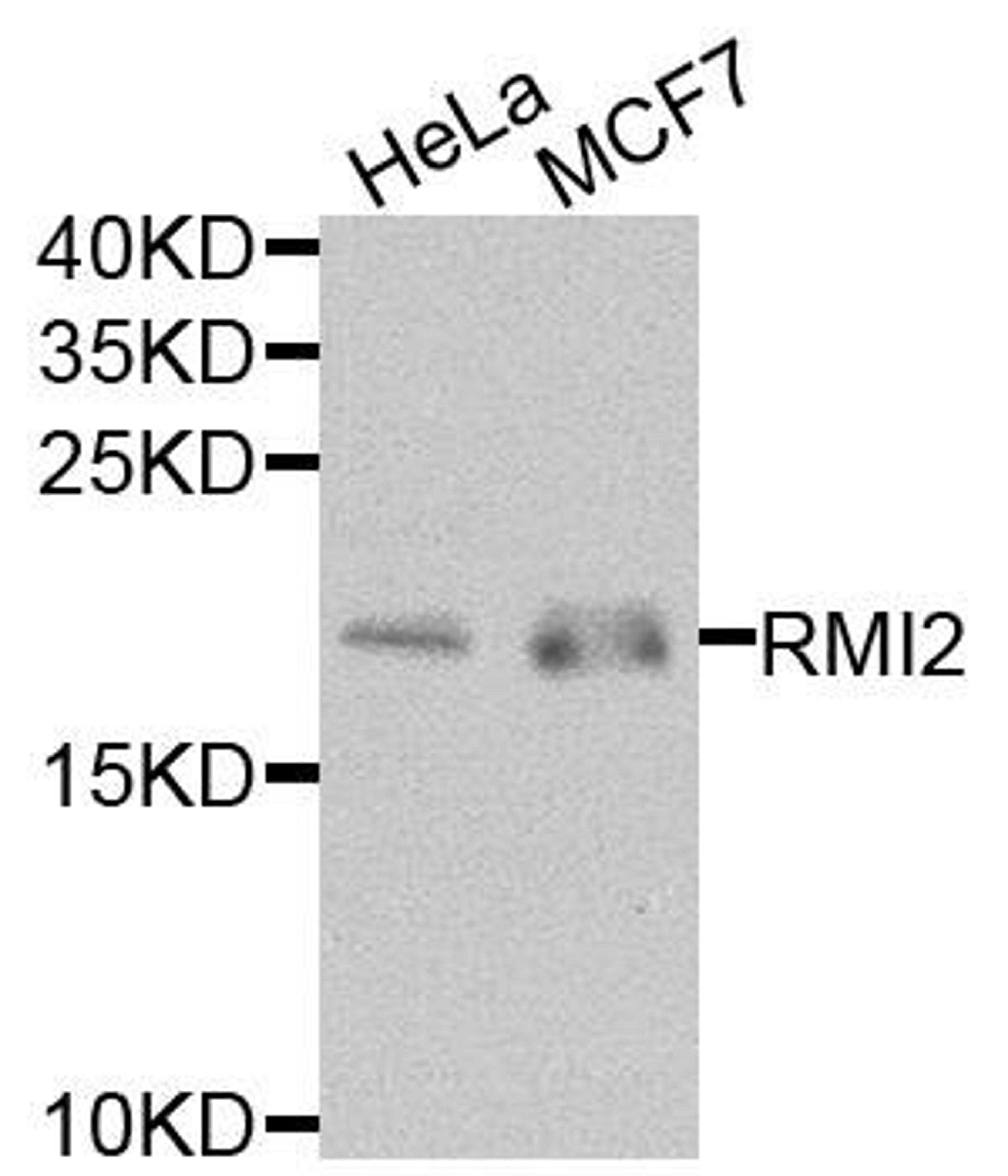 Western blot analysis of extracts of various cells using RMI2 antibody